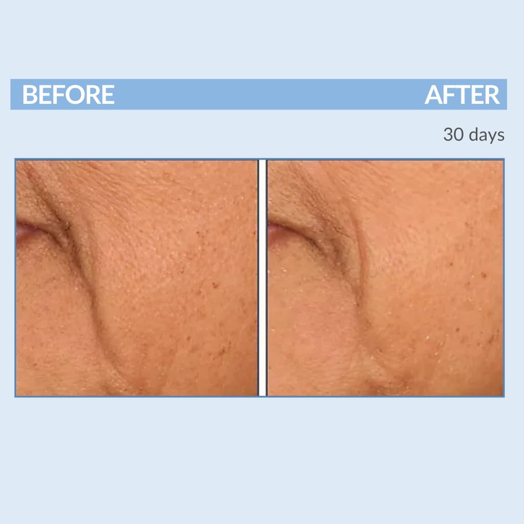 Serious Skincare A Force XR Retinol Serum Concentrate – Time-Release Anti-Aging (2 oz)