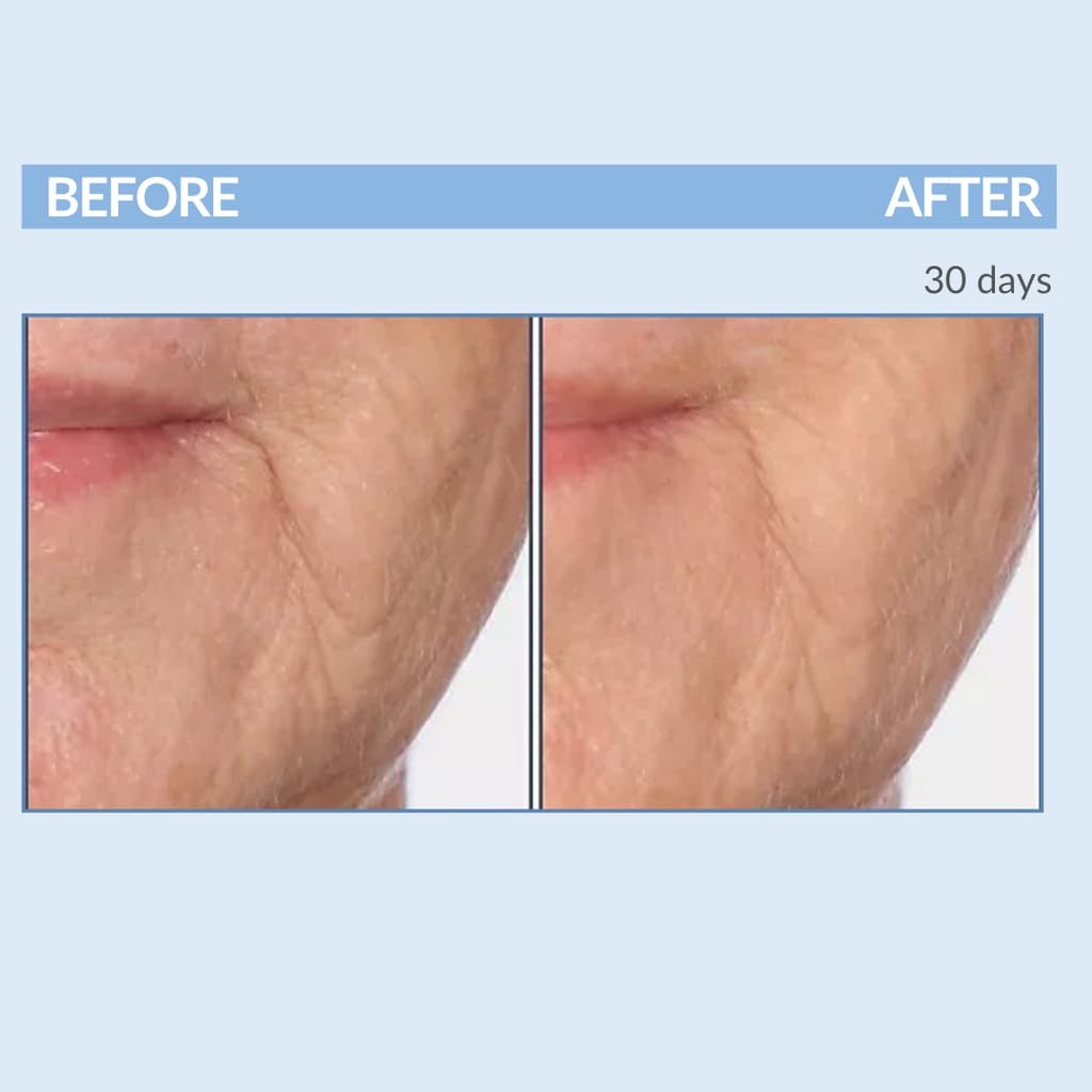 Serious Skincare A Force XR Retinol Serum Concentrate – Time-Release Anti-Aging (2 oz)
