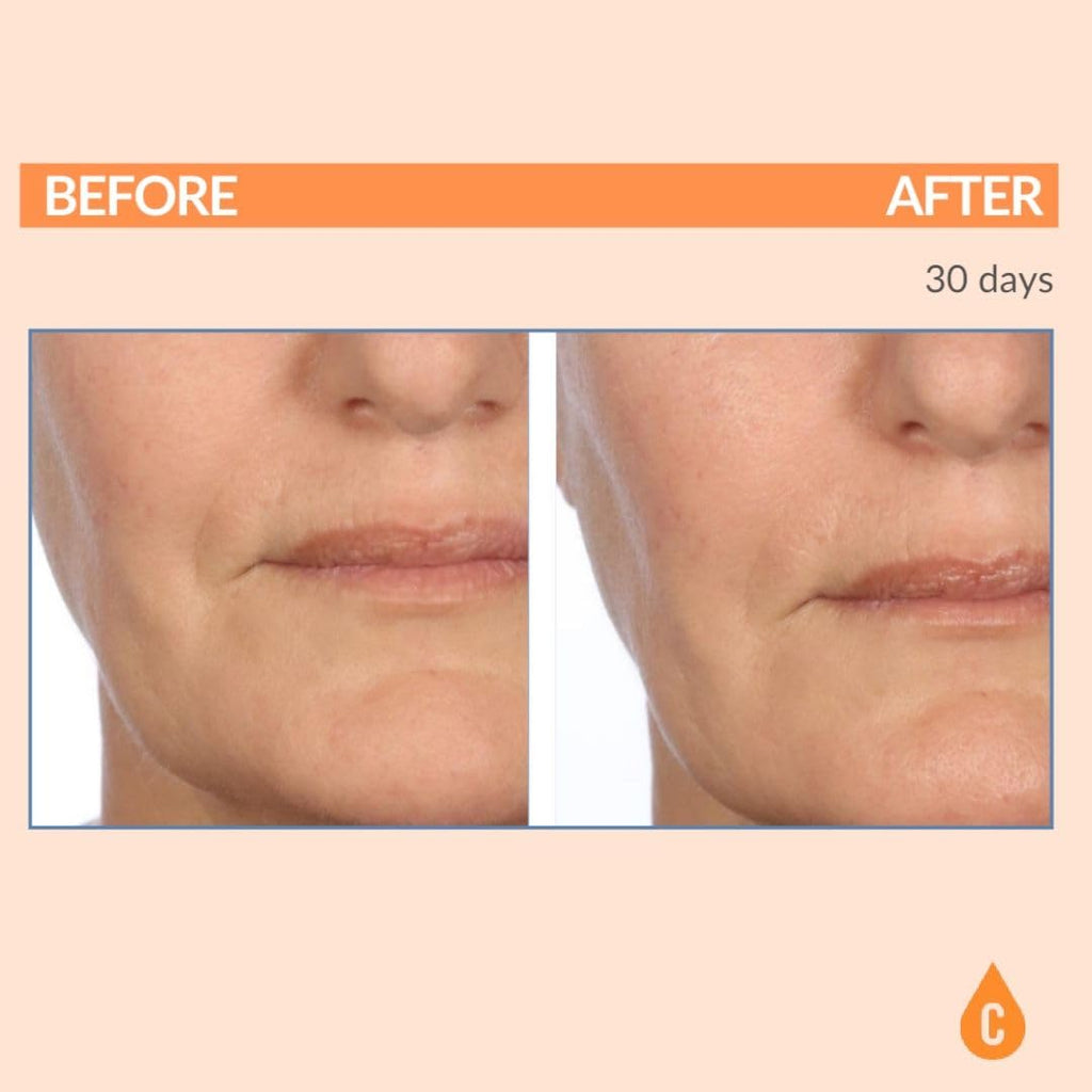 Serious Skincare Vitamin C SPF 30 Broad Spectrum Sunscreen Moisturizer for Face — Hydration, No White Cast