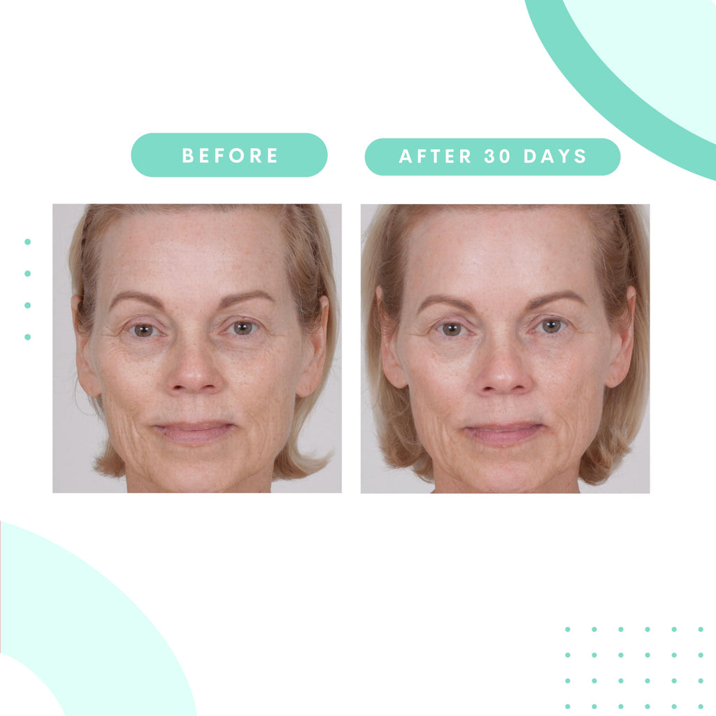 Serious Skincare Glycolic Cleanser – Daily Exfoliating Face Wash with 10% Glycolic
