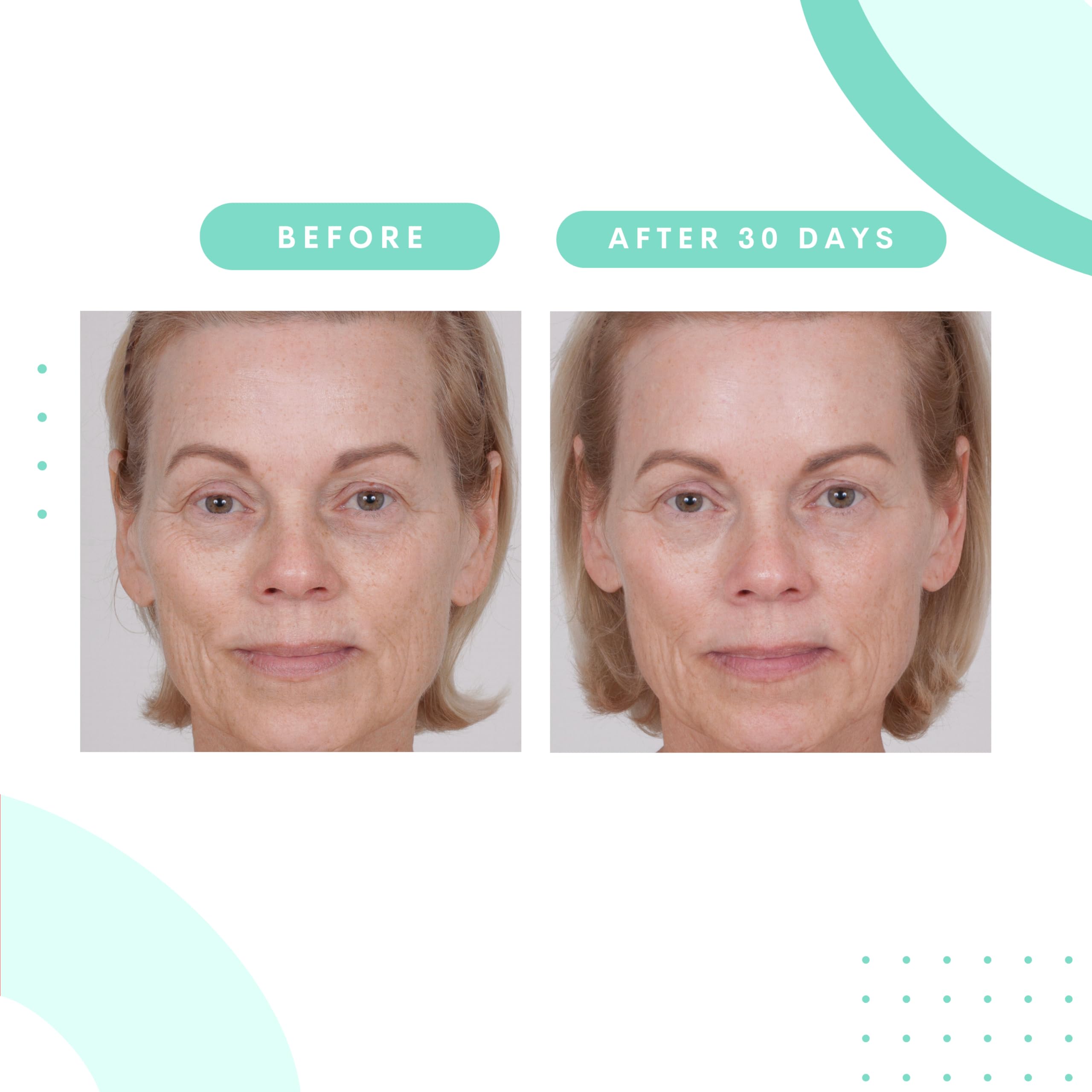 Serious Skincare Glycolic Cleanser – Daily Exfoliating Face Wash with 10% Glycolic