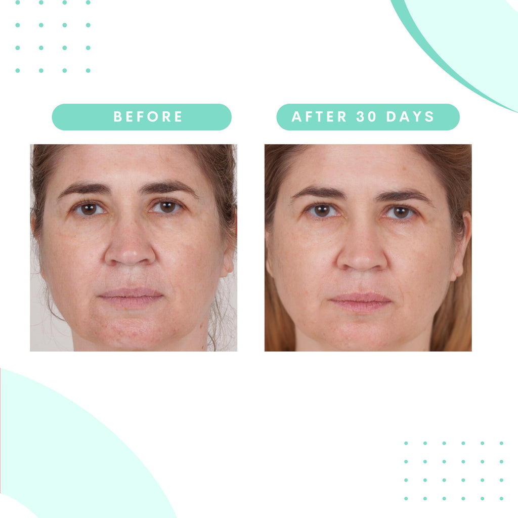 Serious Skincare Glycolic Gommage – Extreme Renewal Facial Mask, Micro Exfoliation