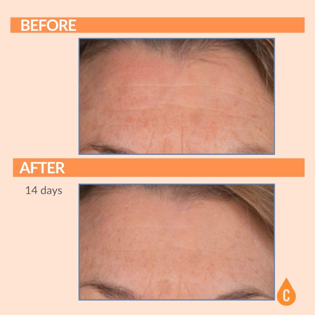 Serious Skincare Vitamin C SPF 30 Broad Spectrum Sunscreen Moisturizer for Face — Hydration, No White Cast