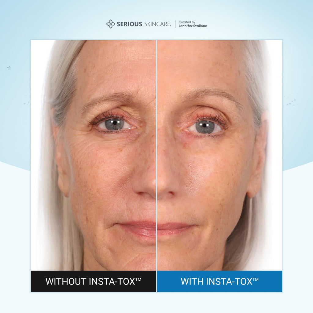Serious Skincare INSTA-TOX Instant Wrinkle Filler – Quick Facial Tightening & Pore Blur 0.75 oz