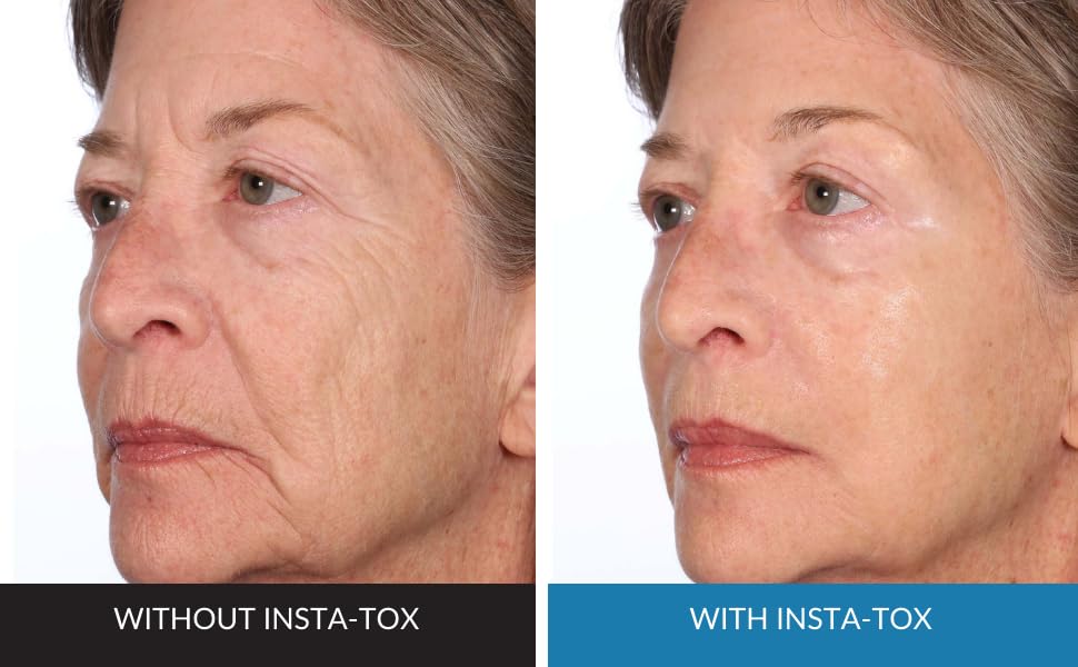 Serious Skincare INSTA-TOX Wrinkle Smoothing Serum .75oz + A Defiance Primer 2oz Duo