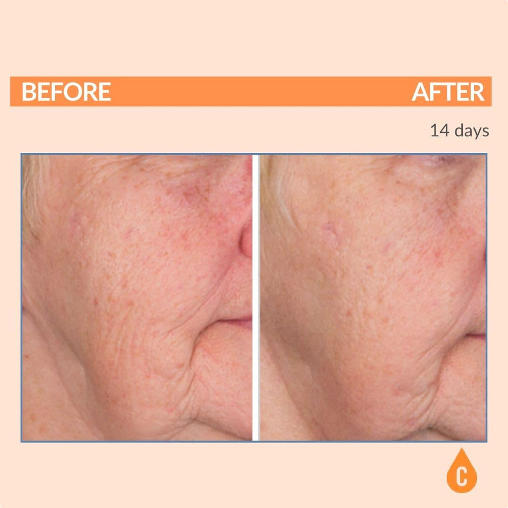 Serious Skincare Vitamin C SPF 30 Broad Spectrum Sunscreen Moisturizer for Face — Hydration, No White Cast
