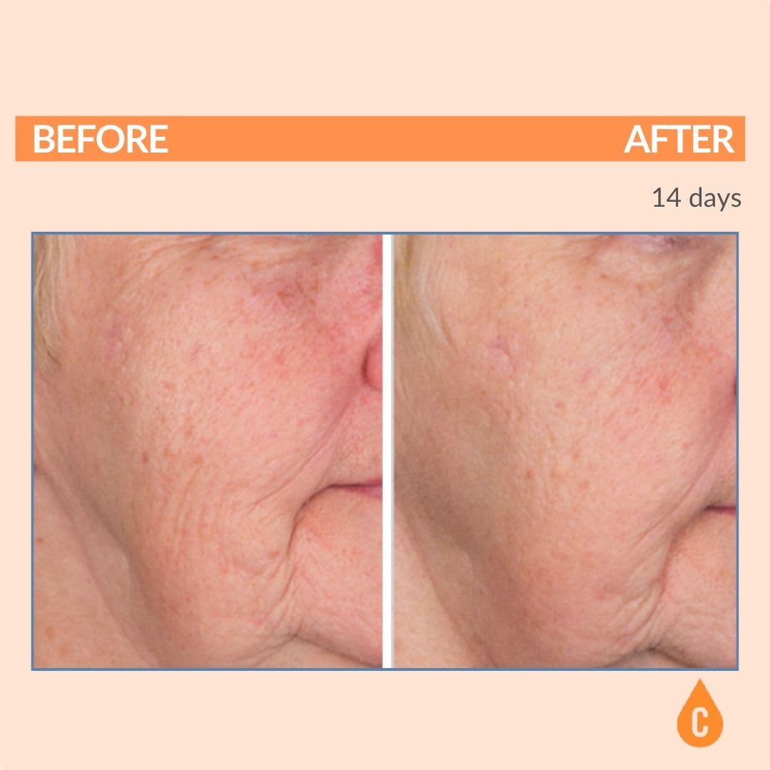 Serious Skincare Vitamin C SPF 30 Broad Spectrum Sunscreen Moisturizer for Face — Hydration, No White Cast