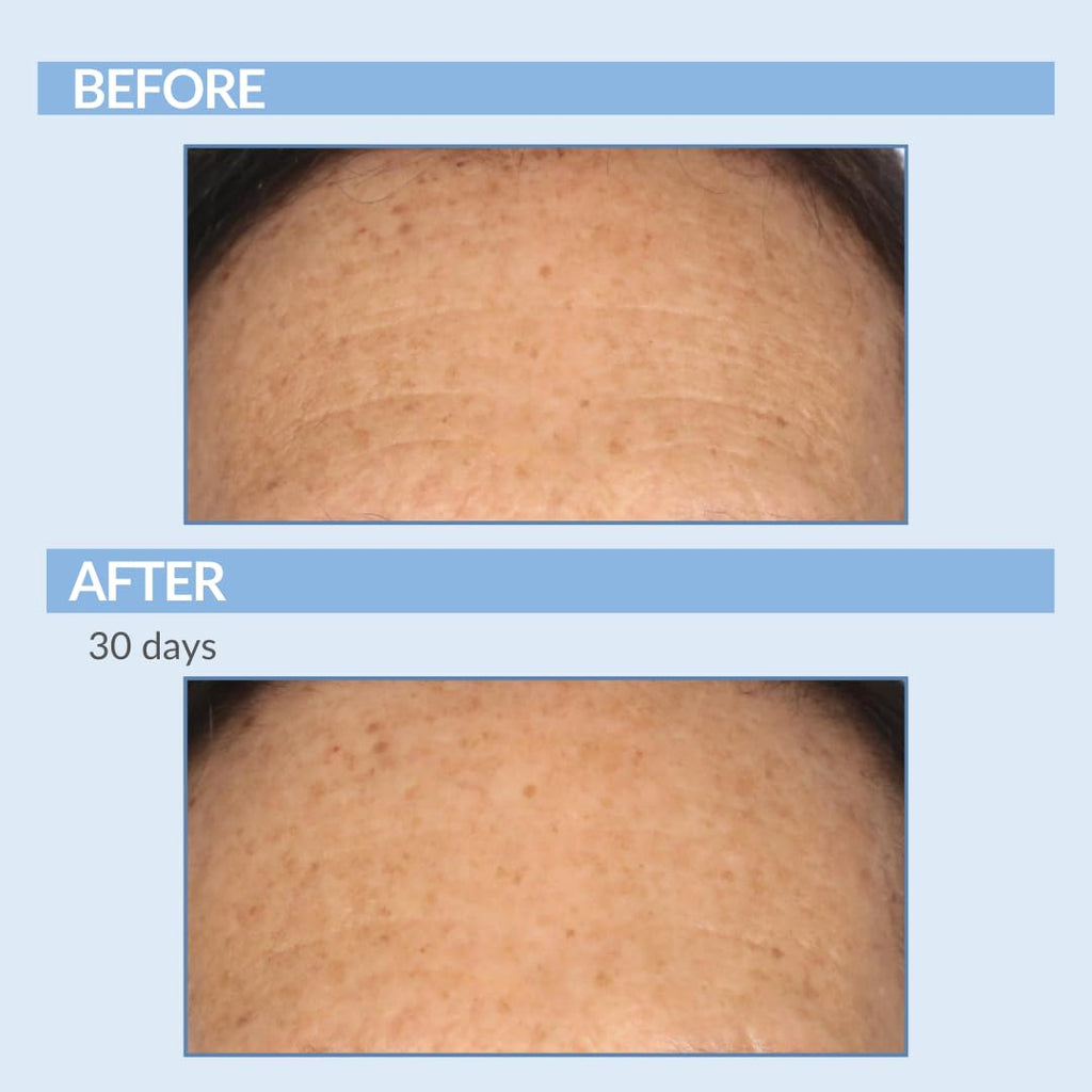 Serious Skincare Retinol Cream for Face - XR Premium Vitamin A Moisturizer (2 oz) | Anti-Aging