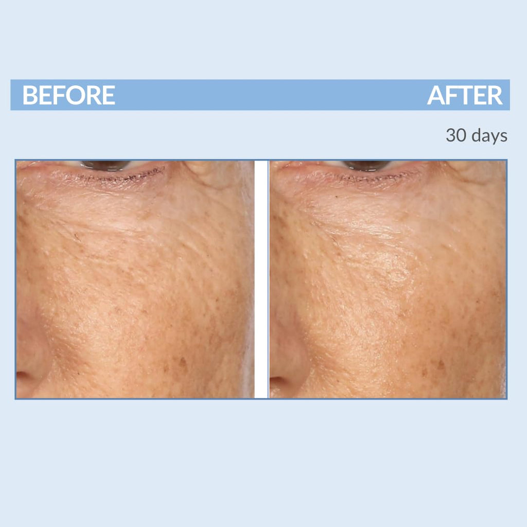 Serious Skincare Retinol Cream for Face - XR Premium Vitamin A Moisturizer (2 oz) | Anti-Aging