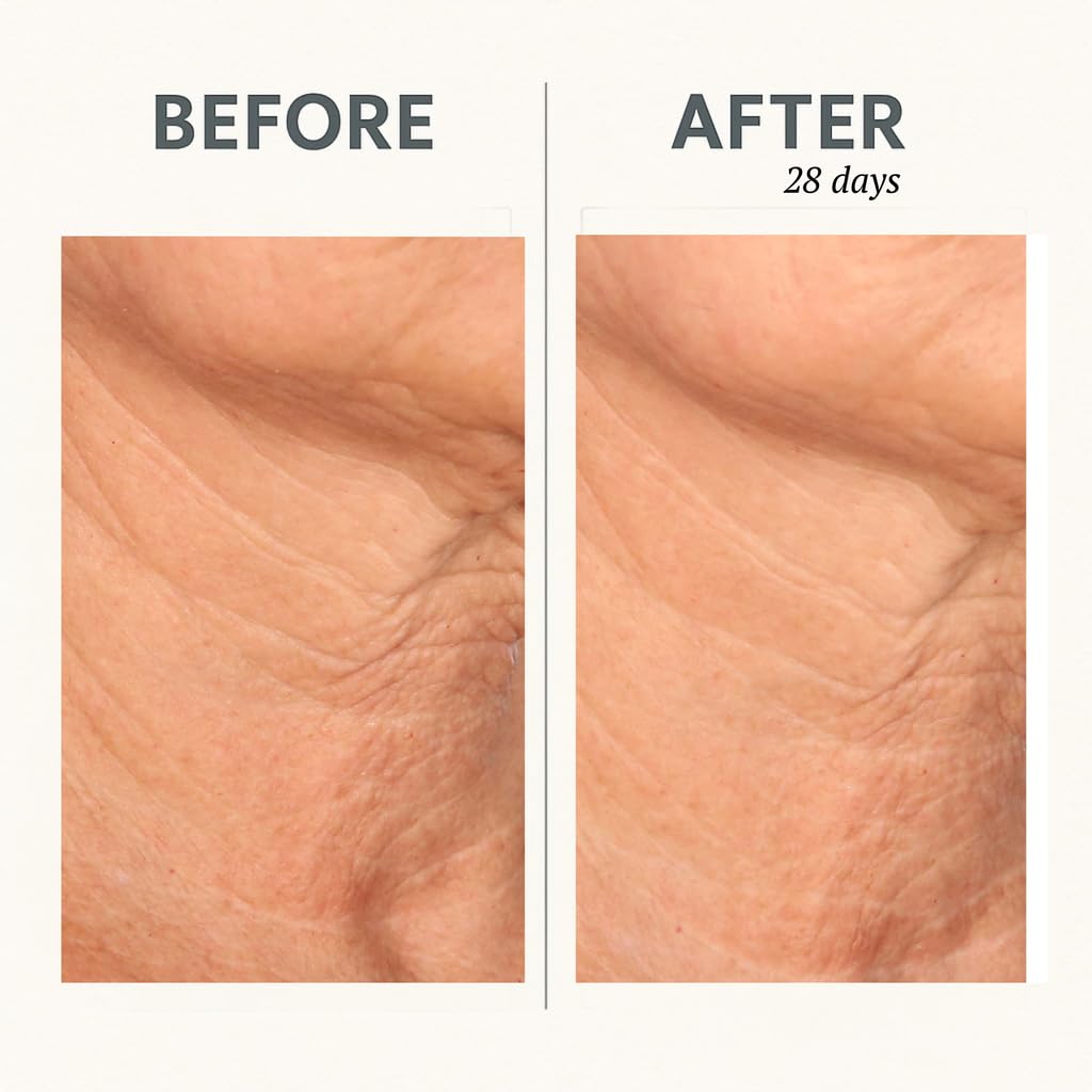 Serious Skincare Reverse Lift CORREC-CHIN IN-TENSE Firming Cream – Neck & Jawline