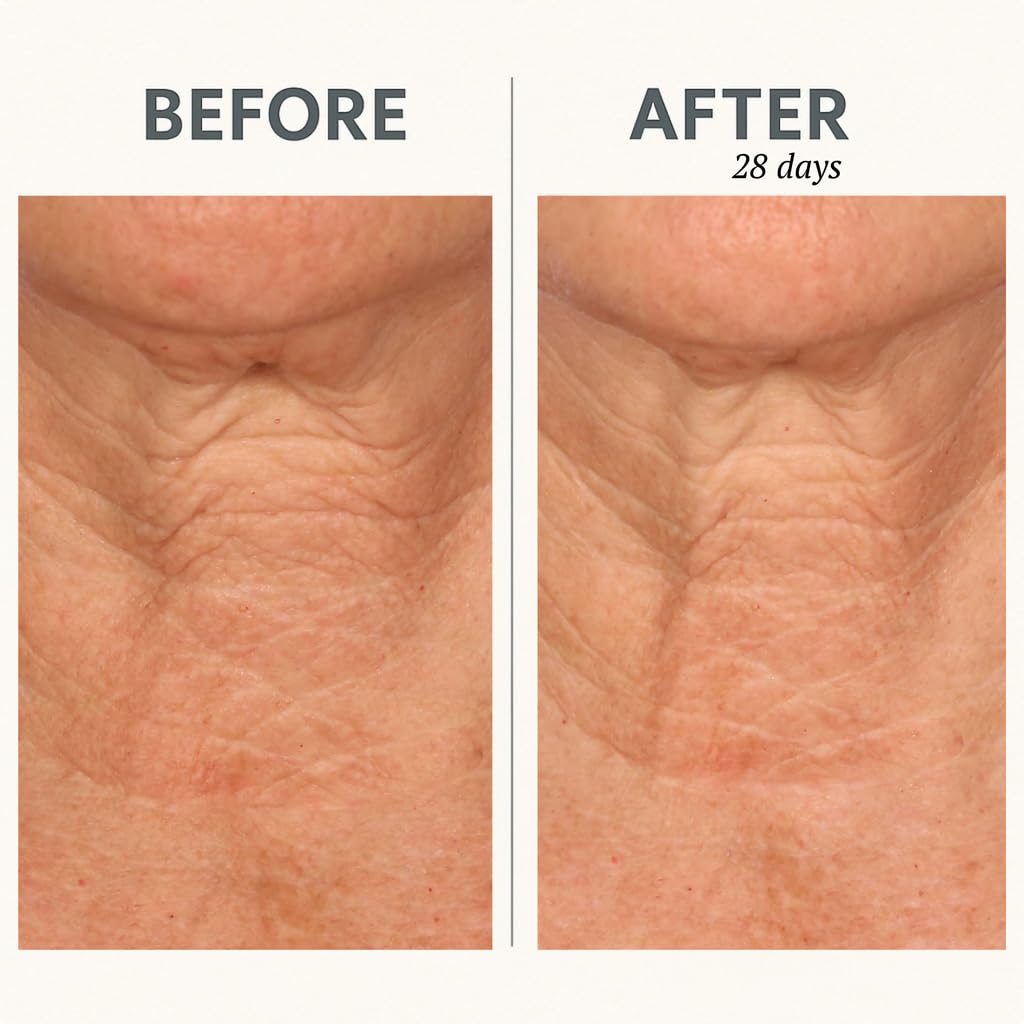 Serious Skincare Reverse Lift CORREC-CHIN IN-TENSE Firming Cream – Neck & Jawline