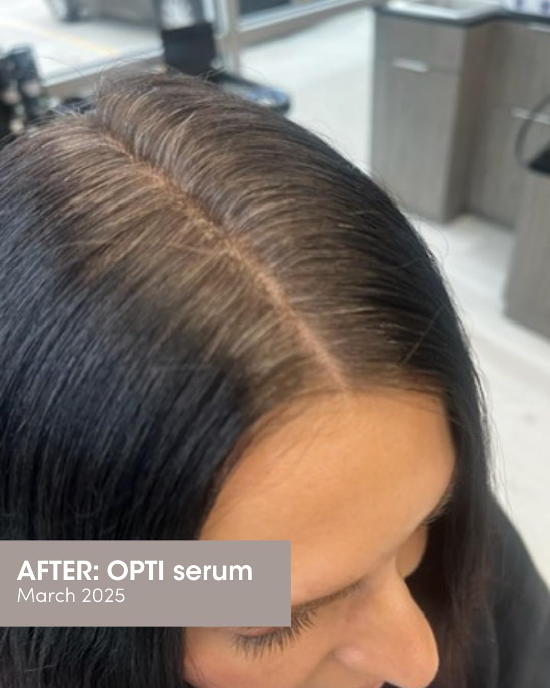 SEVEN SATARA OPTI Shampoo for Hair Growth – Procapil + Capixyl, Plant-Based, 32 oz