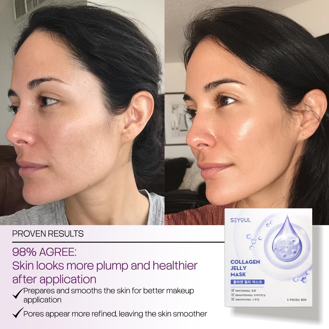 SEYOUL Collagen Jelly Mask – 83% Hydrolyzed Collagen & Niacinamide (5 Sheets)