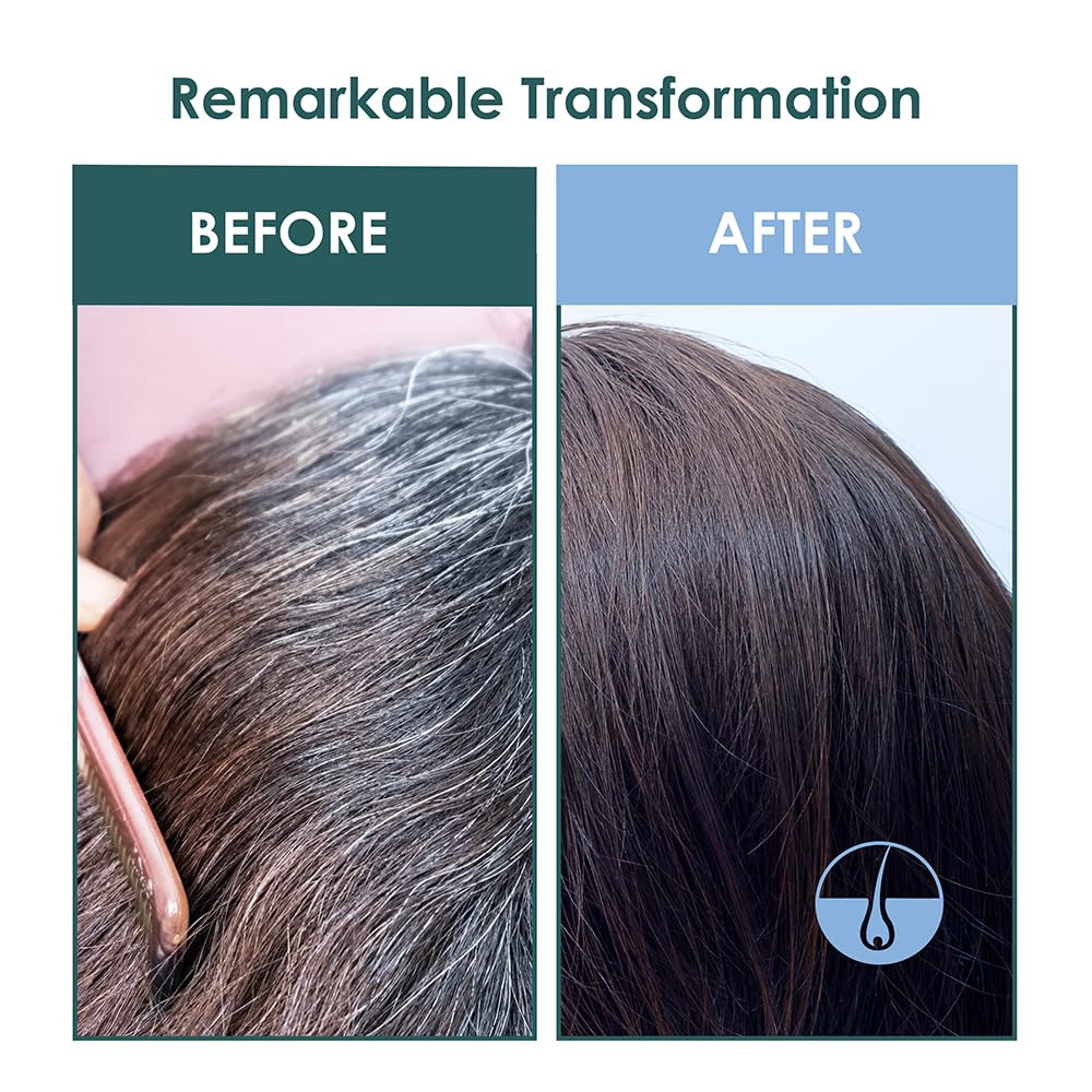 SH-RD Intensive Scalp Essence for Anti-Aging – Lightweight Serum for Hair Growth (50ml)