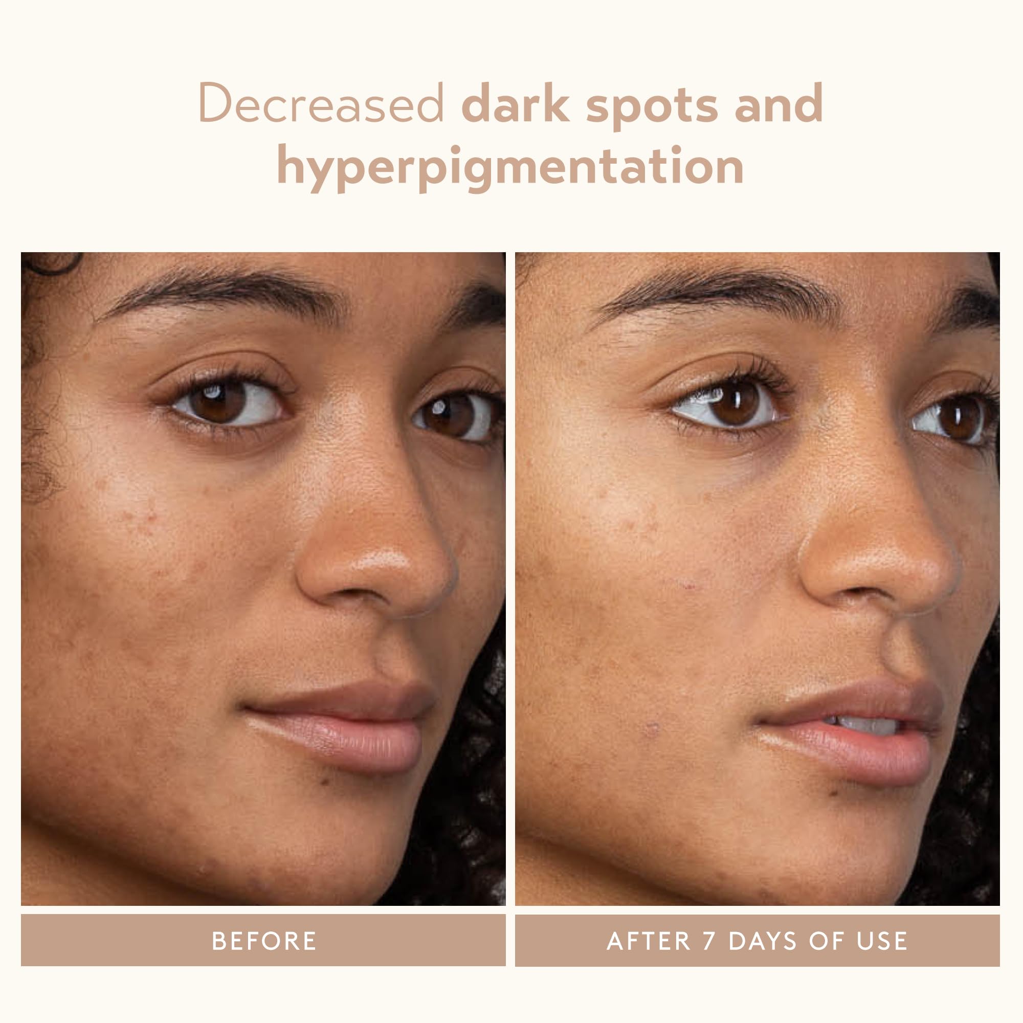 SHANI DARDEN Lactic Acid Face Serum | Night Exfoliating Serum for Radiant, Smooth Skin