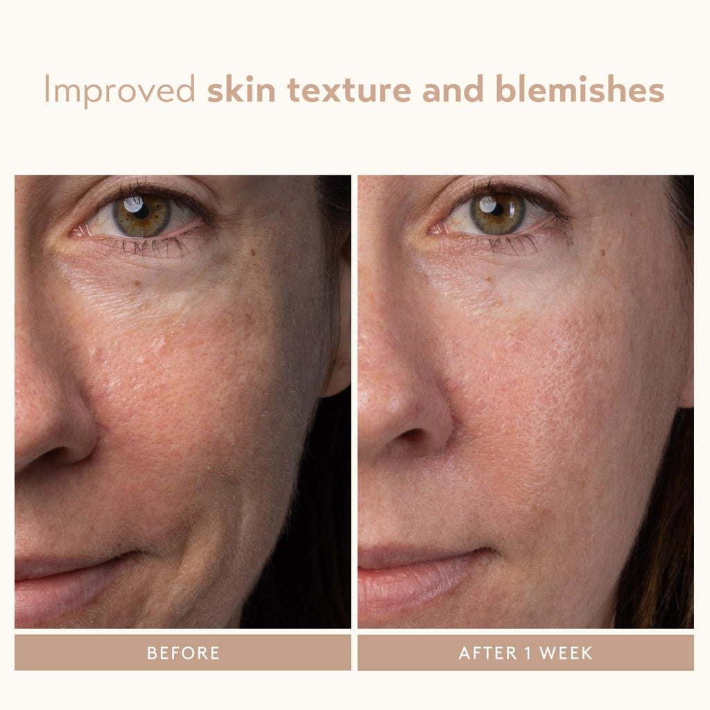 SHANI DARDEN Lactic Acid Face Serum | Night Exfoliating Serum for Radiant, Smooth Skin
