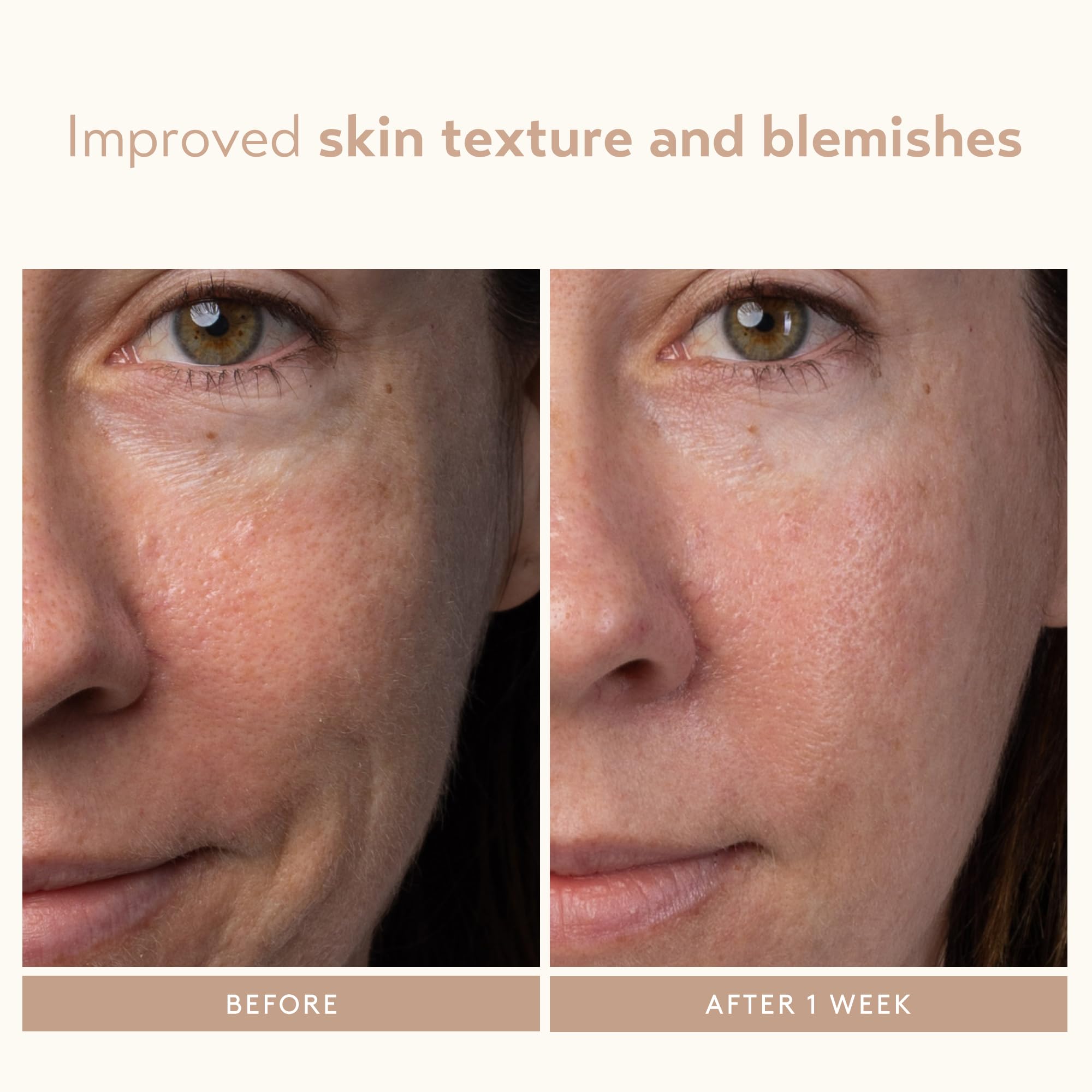 SHANI DARDEN Lactic Acid Face Serum | Night Exfoliating Serum for Radiant, Smooth Skin