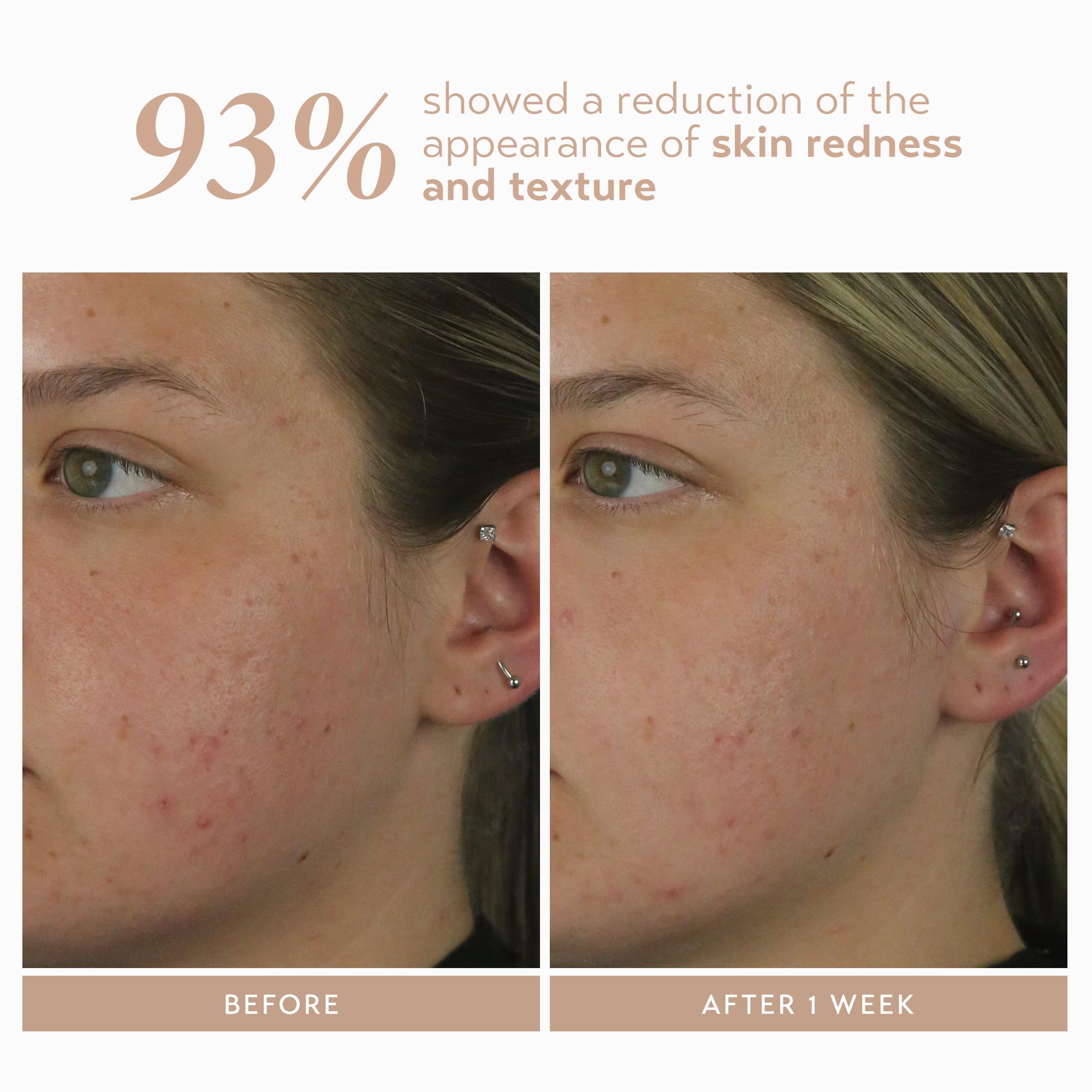 Shani Darden Rescue Serum with 10% Azelaic Complex | Lightweight Hydration