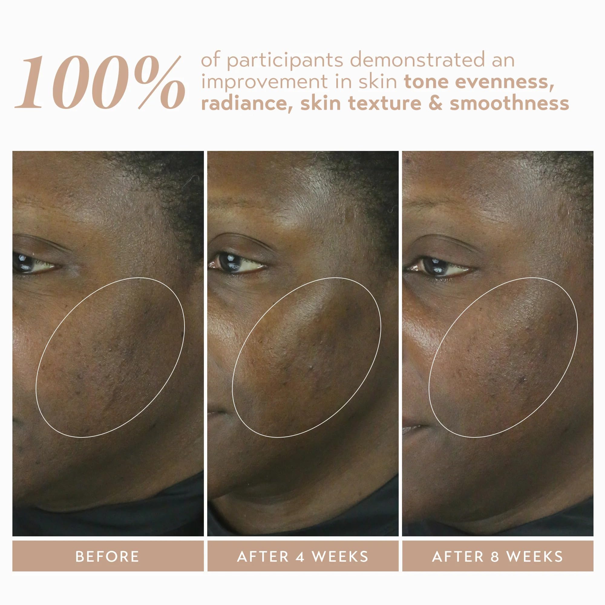 SHANI DARDEN Retinol Reform 1% Encapsulated Retinol Serum for Face & Neck – Gentle, Slow-Release with Tripeptide