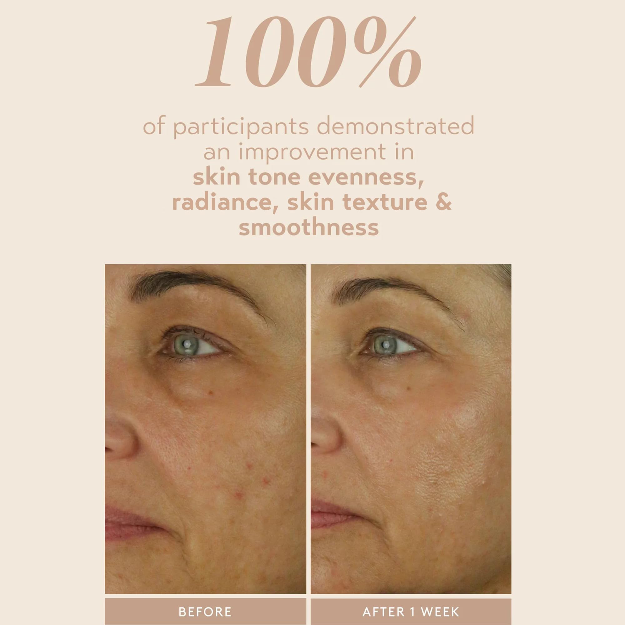 SHANI DARDEN Retinol Reform — 1% Encapsulated Retinol Serum for Face & Neck, Gentle Slow-Release, 0.3 oz