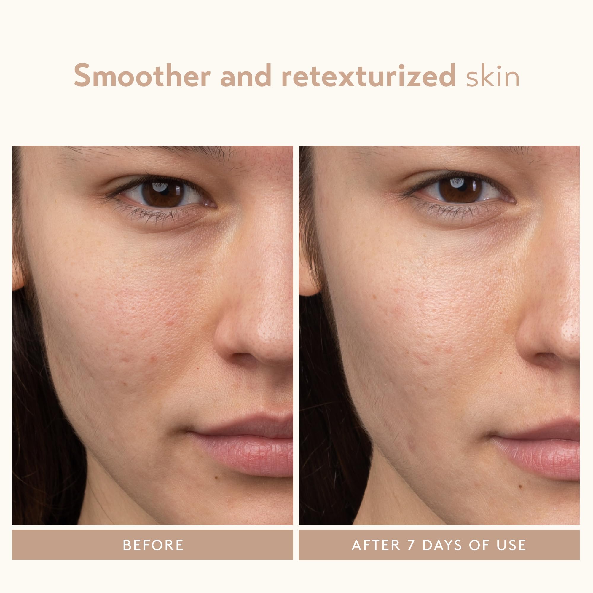 SHANI DARDEN Lactic Acid Serum | Travel Size Night Exfoliator for Radiant, Smooth Skin