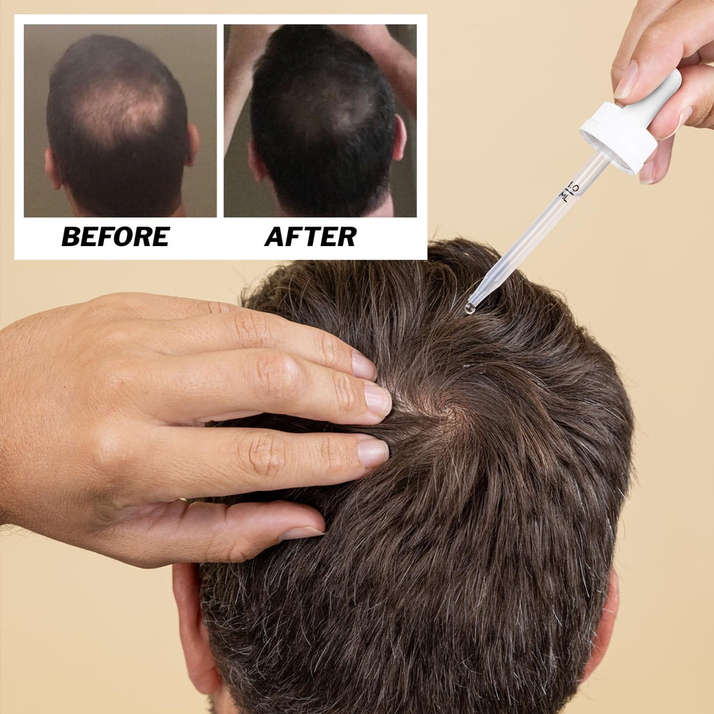 Shapiro MD Men's Regrowth Kit Plus: 5% Minoxidil, Shampoo, Conditioner & Leave-In Foam