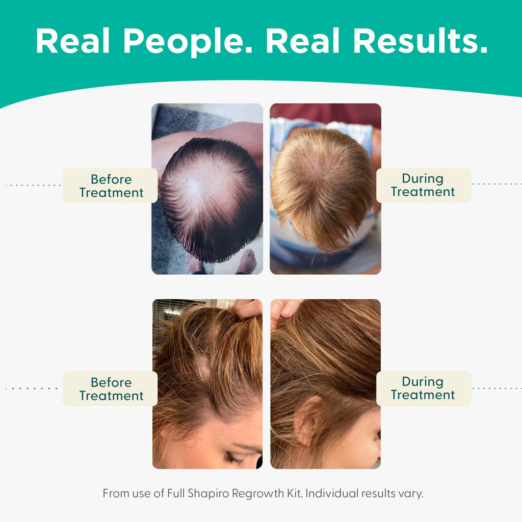 Shapiro MD Leave-In Daily Foam – DHT-Fighting Vegan Hair Growth Solution