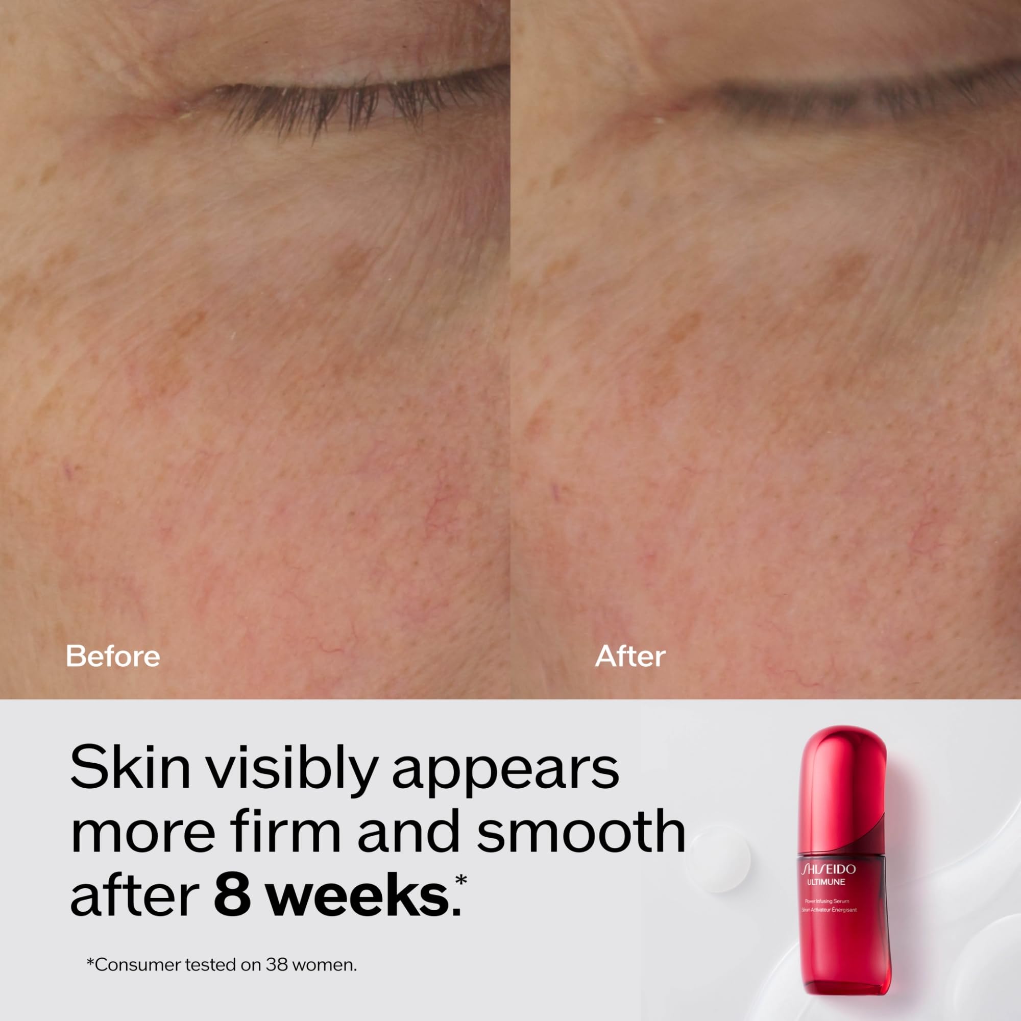 Shiseido Ultimune Power Infusing Serum Jumbo – 4 oz | Boost Radiance & Improve Visible Signs of Aging