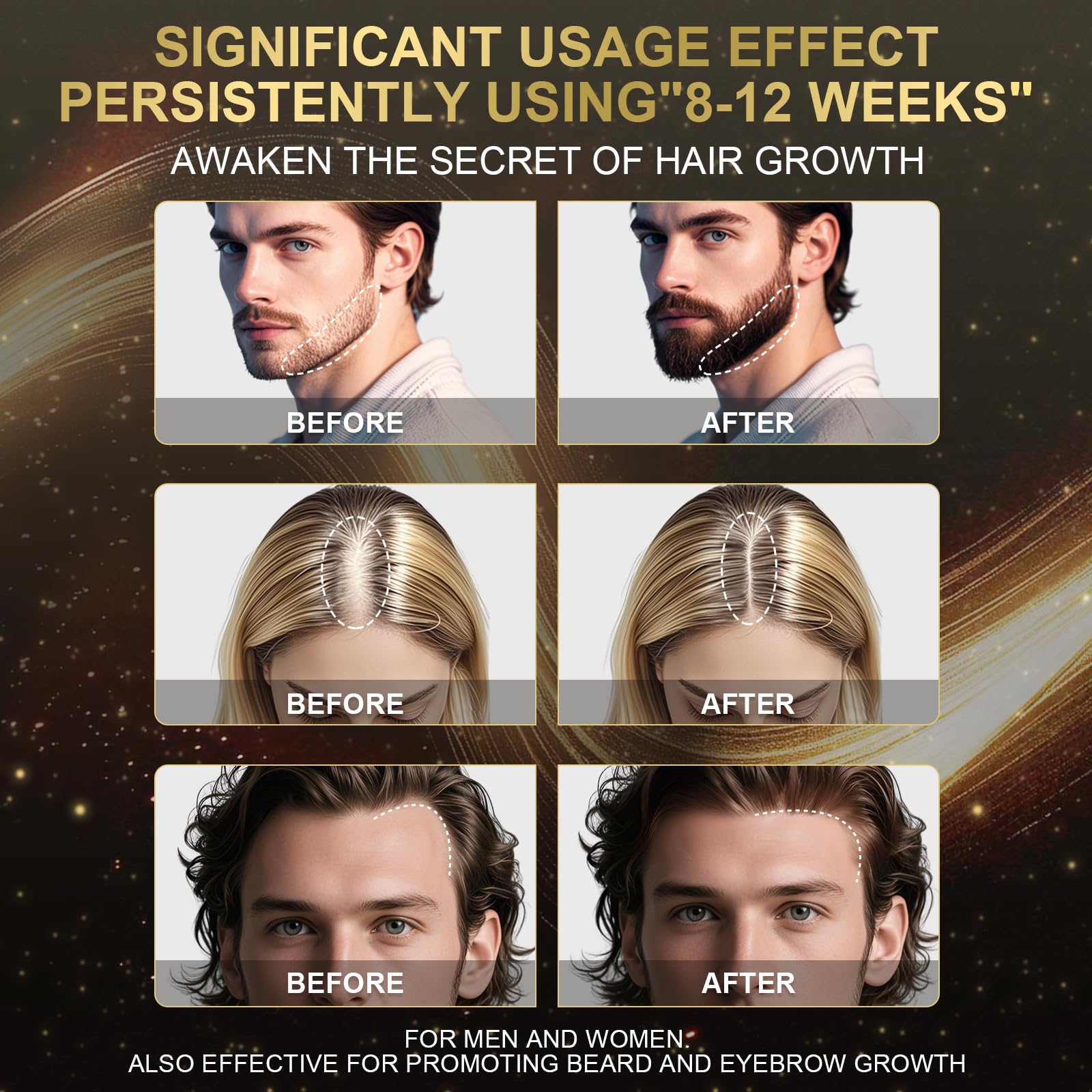 Sidinox 5% Minoxidil Foam for Men & Women – Biotin-Boosted Hair Growth, 3-Month Supply