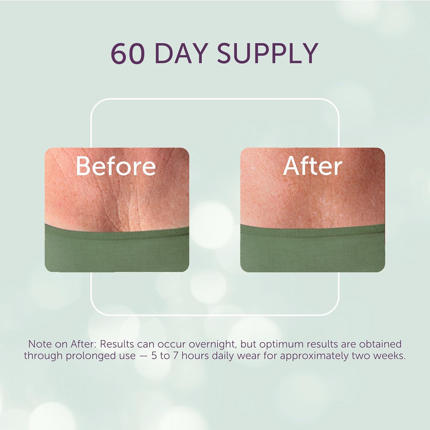 Silc Skin Decollette Pad – Reusable Chest Patch for Sleep Lines & Sun Damage | 60 Day Supply