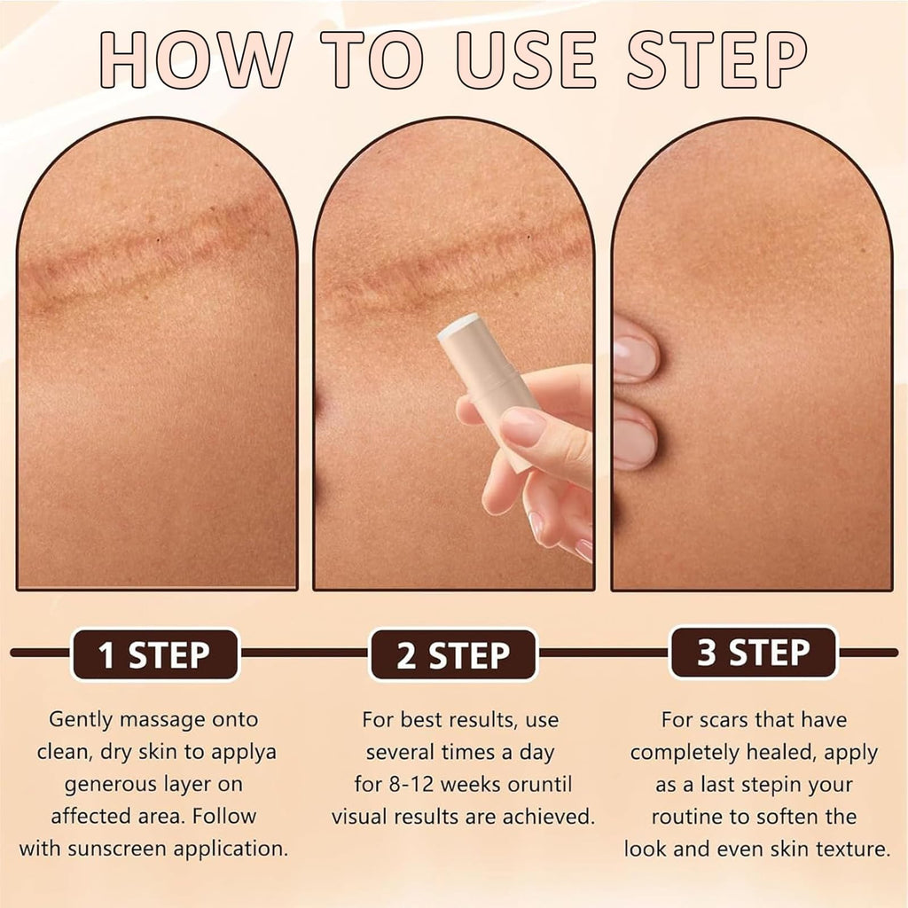 Silicone Scar Stick – 60% Silicone for Face & Body (2 Pack)