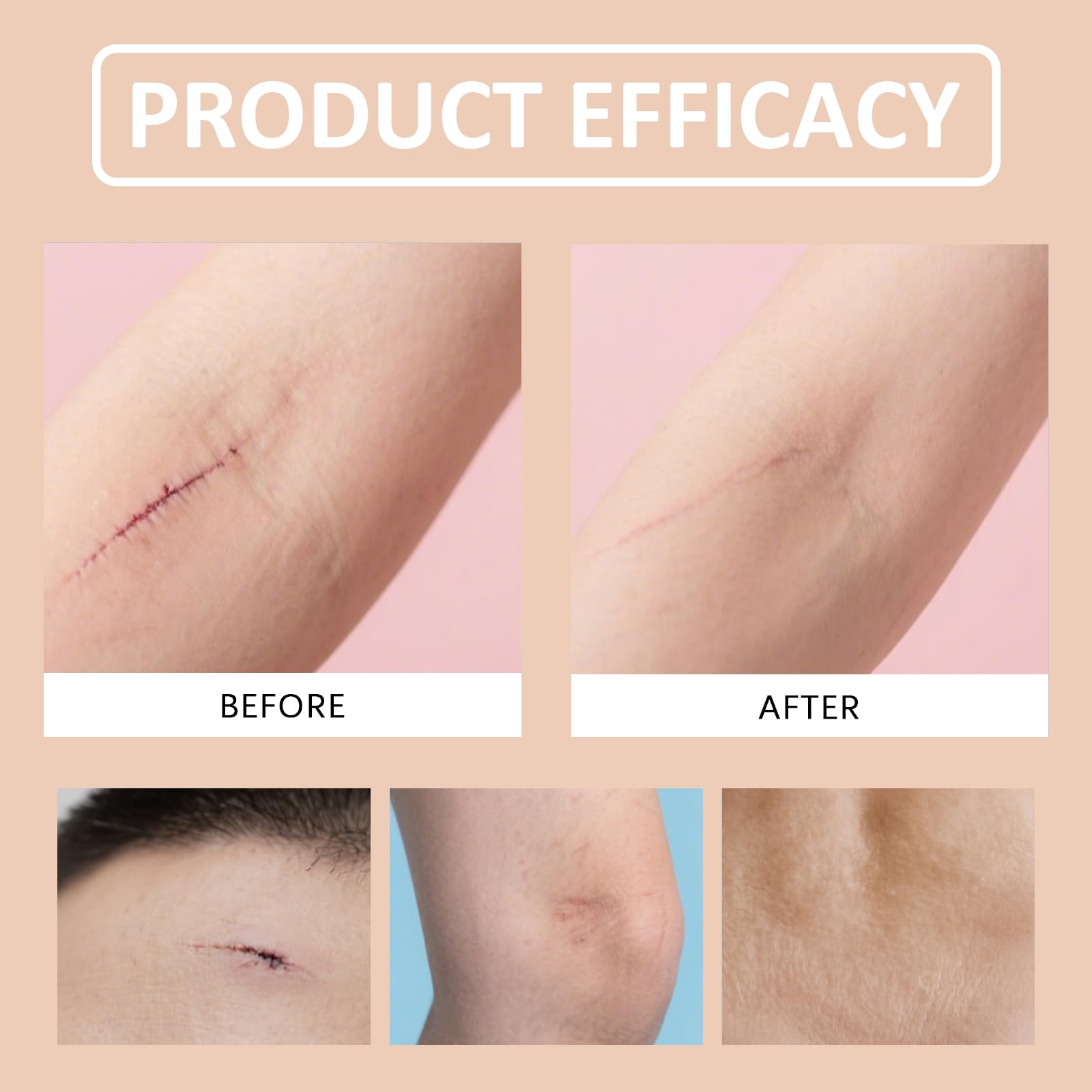 Silicone Scar Stick – 60% Silicone for Face & Body (2 Pack)