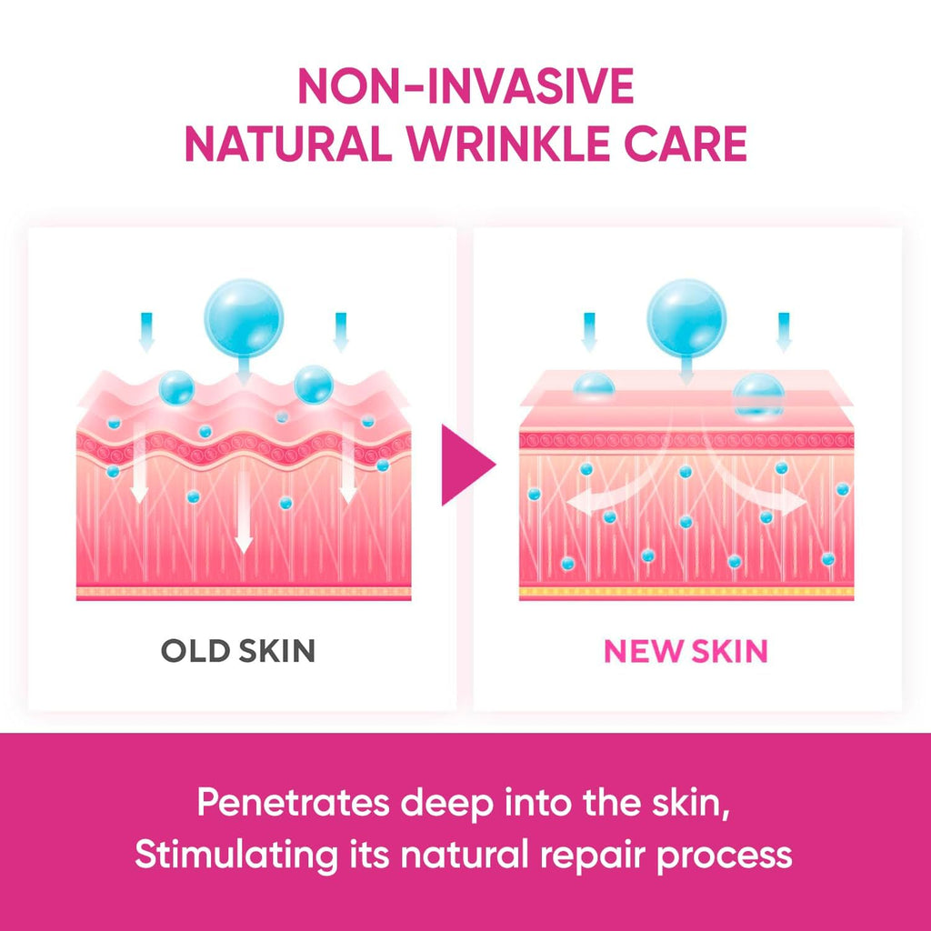 SILKDERMIS Facial Wrinkle Patches – Overnight Forehead Wrinkle Treatment, 144 Patches (Red)