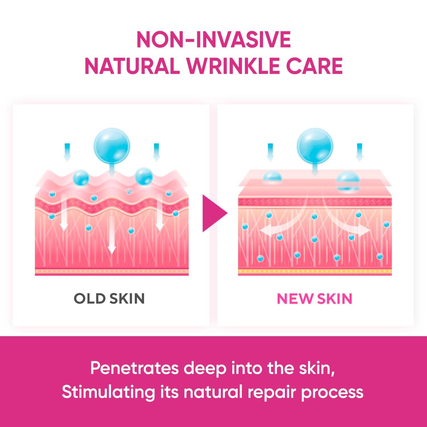 SILKDERMIS Facial Wrinkle Patches – Overnight Forehead Wrinkle Treatment, 144 Patches (Red)