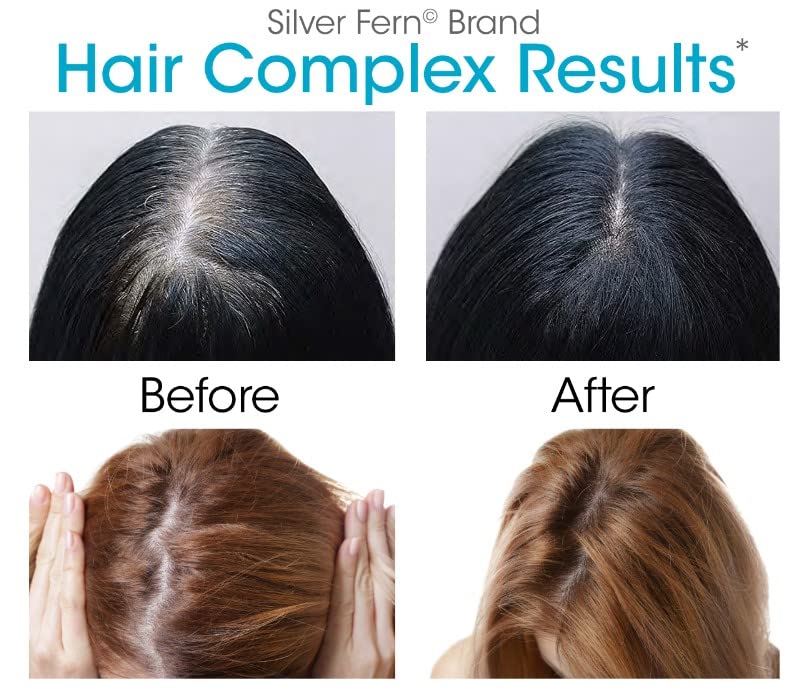 Silver Fern Hair Complex Hair Supplement – 30-Day Supply per Bottle (1 Capsule Daily)
