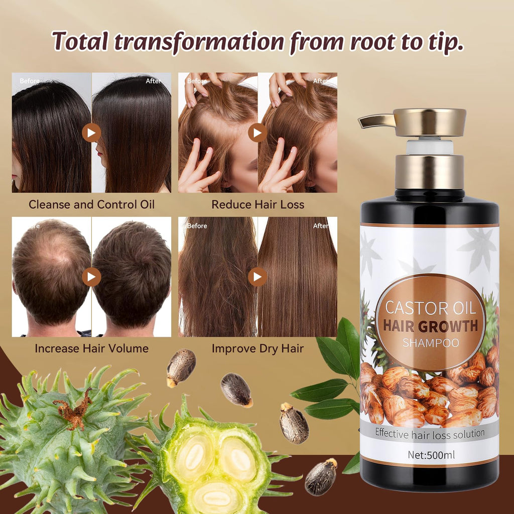 Silvercell Castor Oil Shampoo for Hair Growth – Strengthen Roots & Nourish Dry Hair (16.91 fl oz)