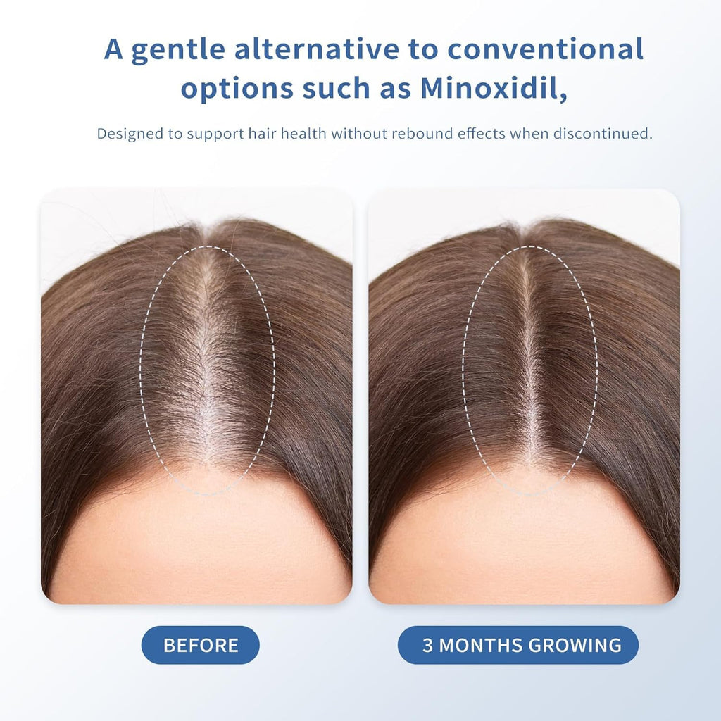 Hair Growth Serum for Thinning Hair | Singrace Biotin Roll-On – Fast Absorbing, No Rinse (30ml)