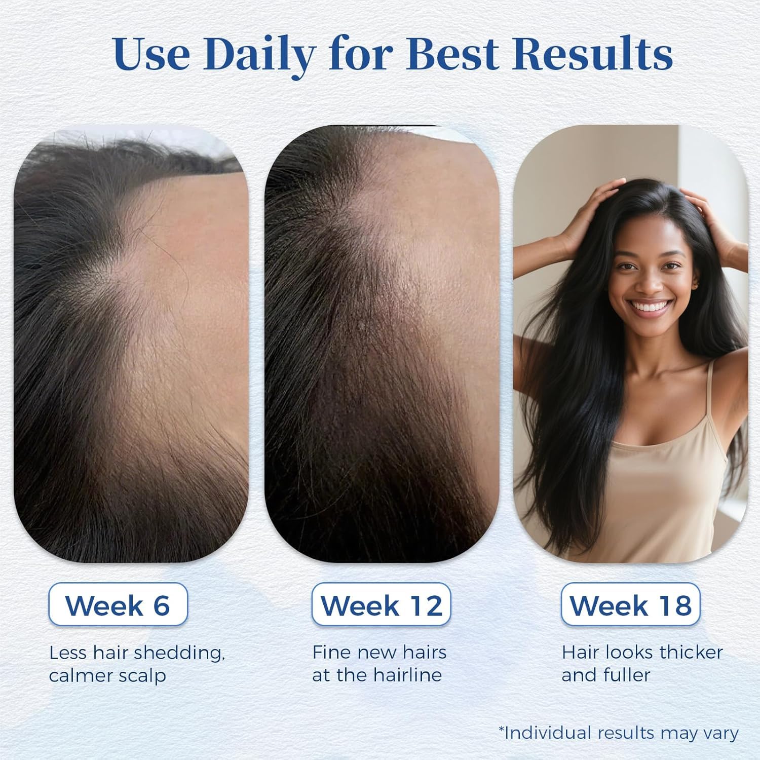 Hair Growth Serum for Thinning Hair | Singrace Biotin Roll-On – Fast Absorbing, No Rinse (30ml)