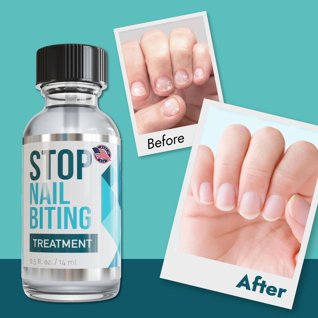 SISQUOC HEALTHCARE Stop Nail Biting Treatment – Clear Bitter Nail Polish for All Ages (3x0.5 fl oz)