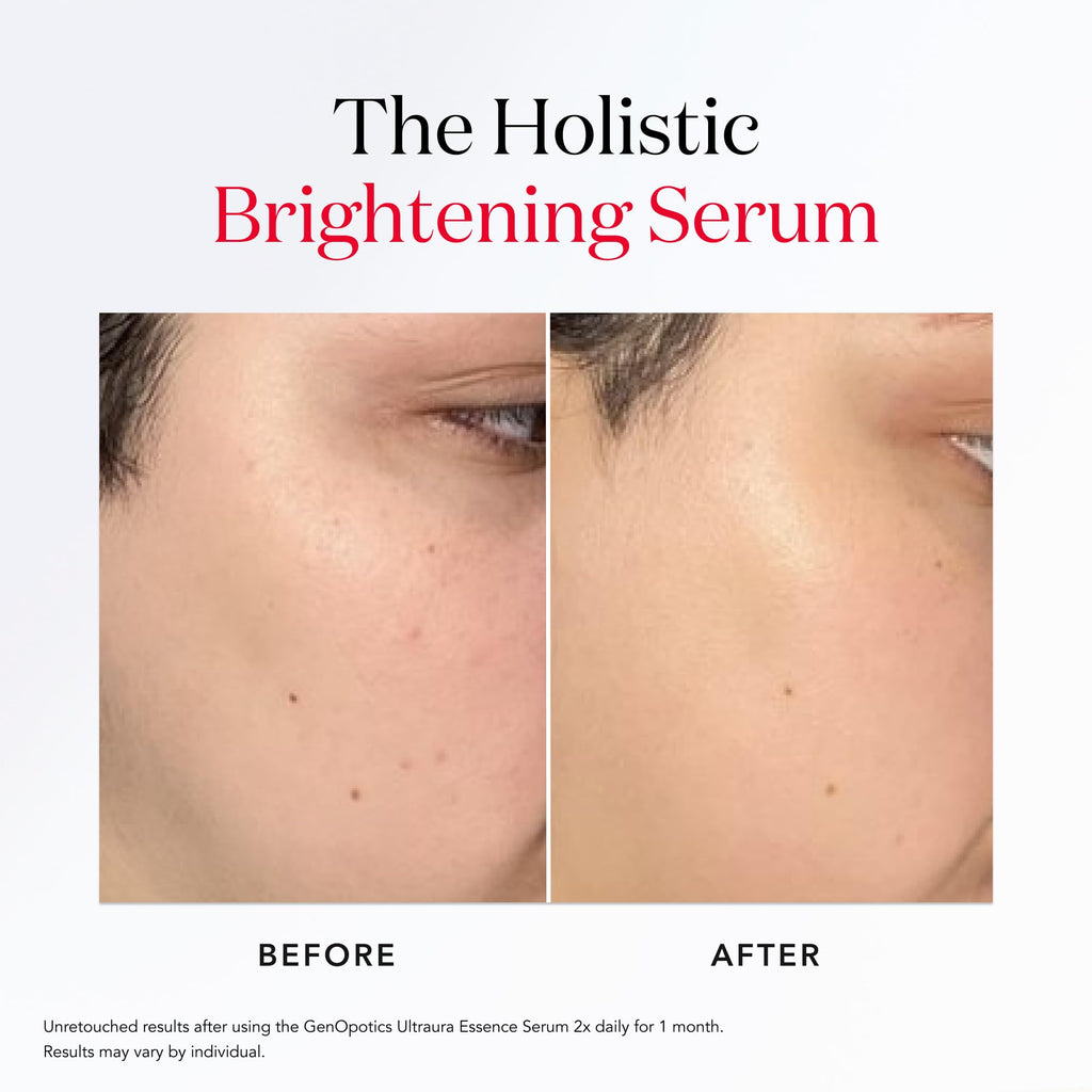 SK-II GenOptics Essence Brightening Serum – Target Sun Spots, Dullness & Uneven Texture (1.7 oz)