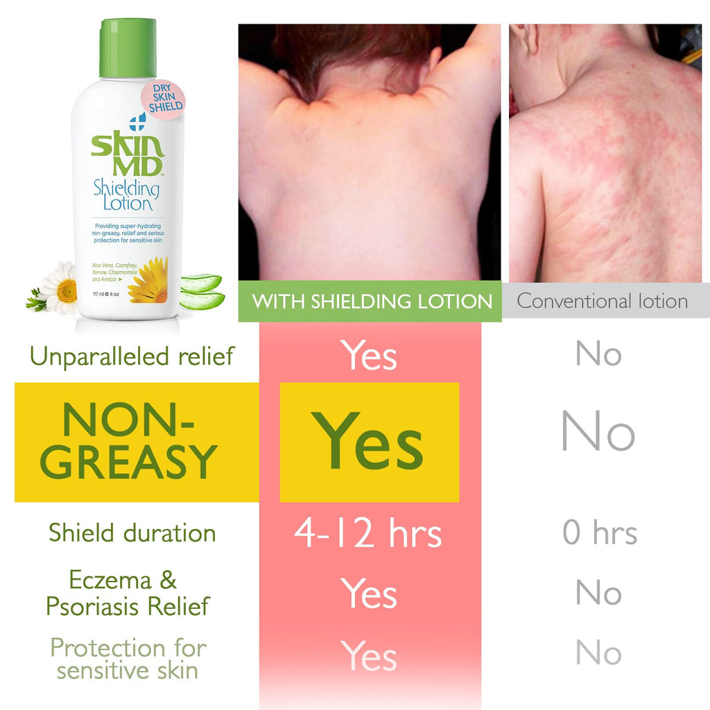 Skin MD Shielding for Face & Body | Hypoallergenic Moisturizer (8 oz)