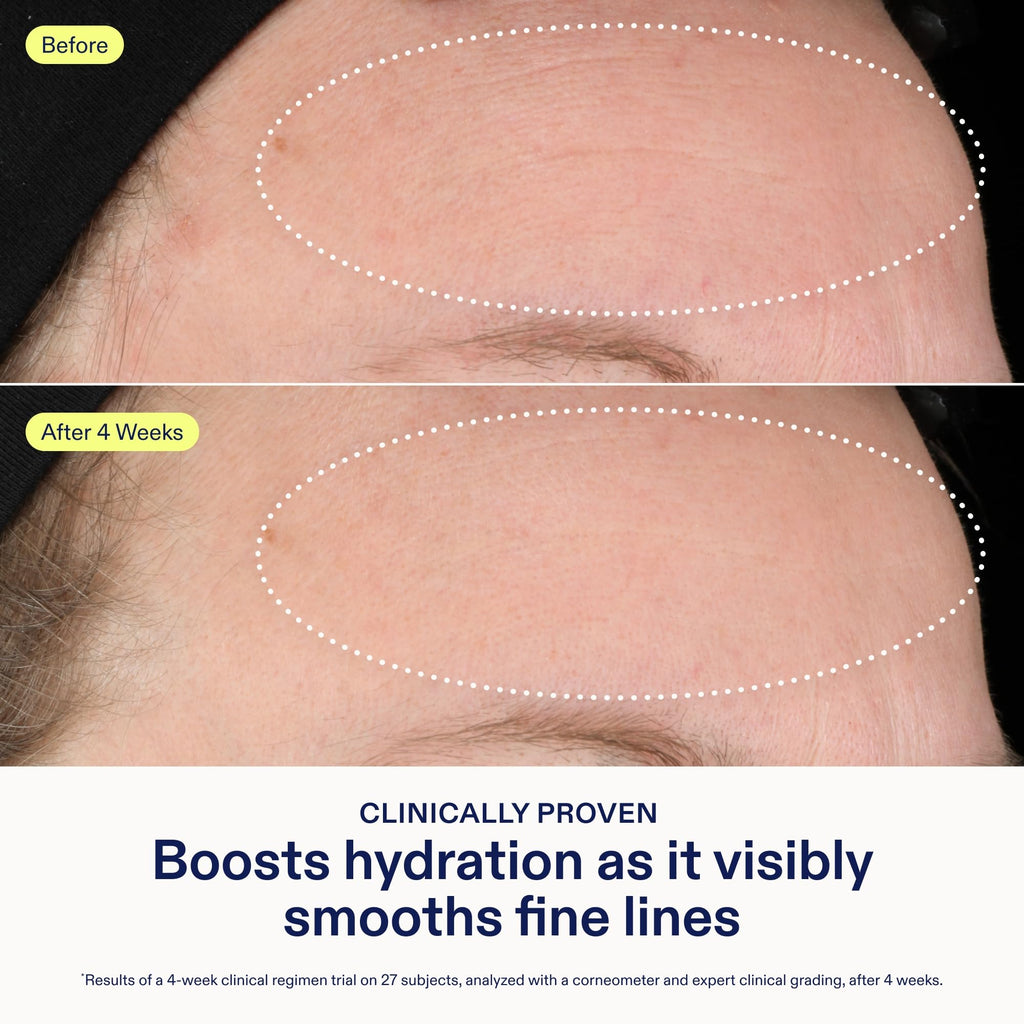 Skinfix Triple Lipid-Hyaluronate Serum | Hydrating Facial Serum 1 oz