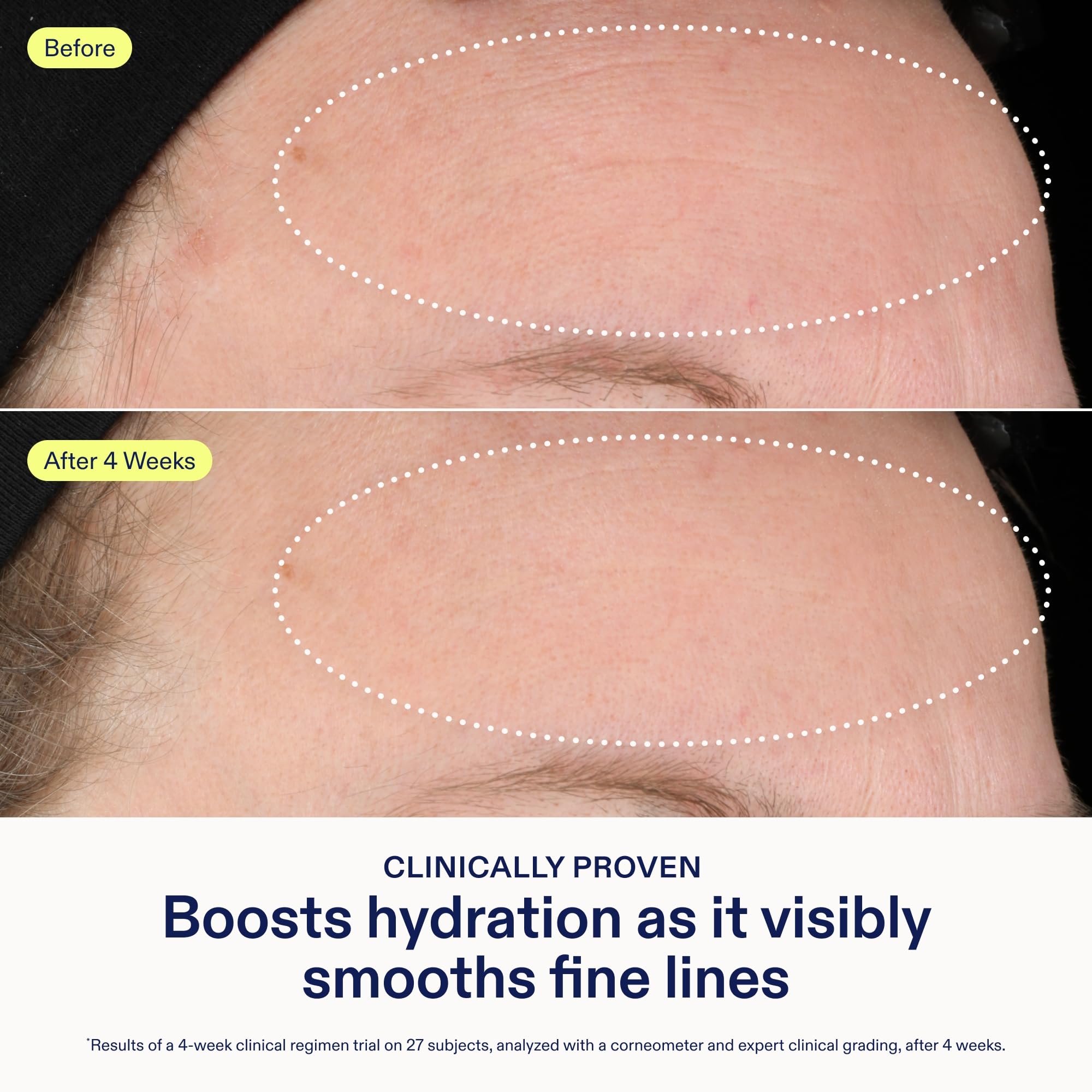 Skinfix Triple Lipid-Hyaluronate Serum | Hydrating Facial Serum 1 oz