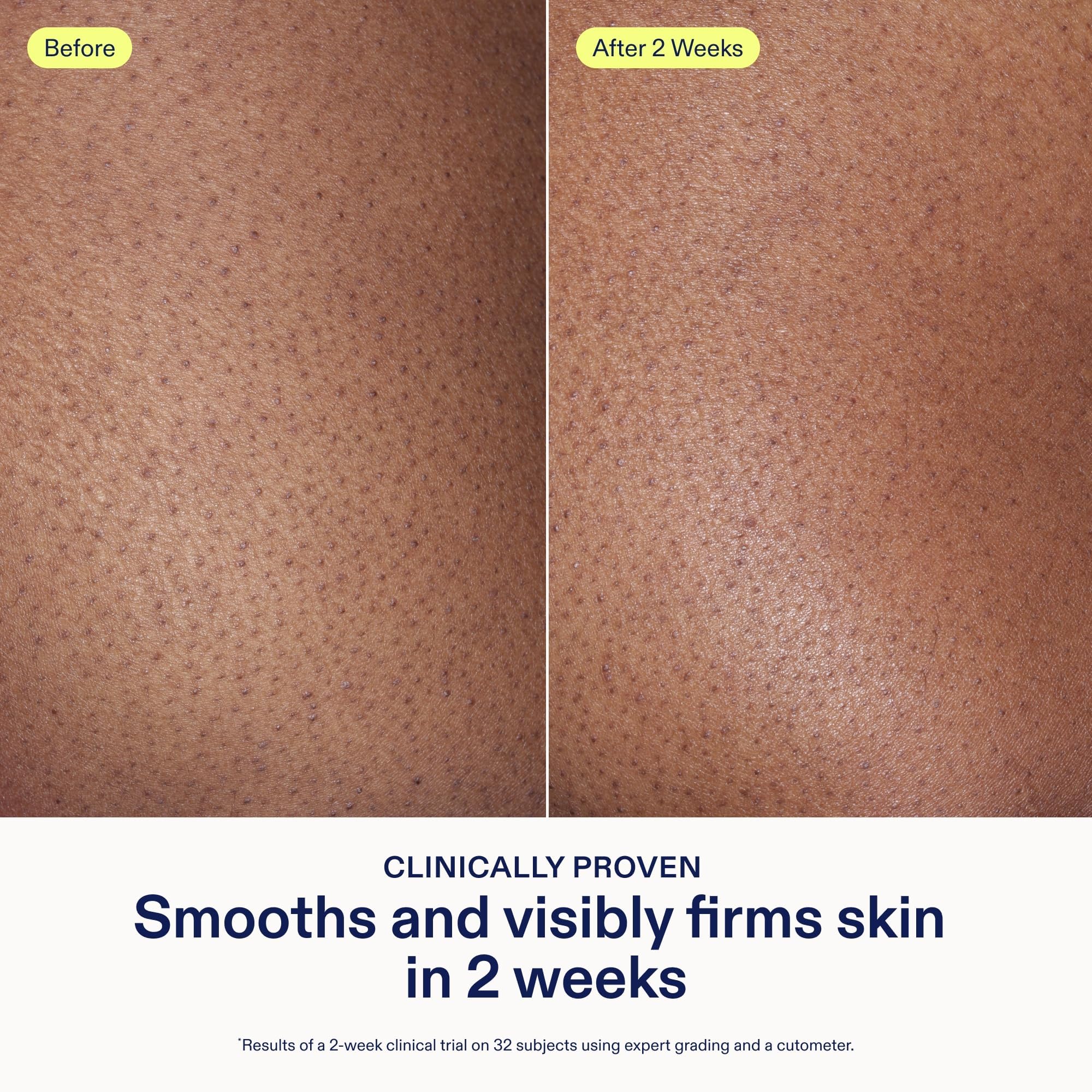 Skinfix AHA/BHA Renewing Body Cream – 10 oz | Gentle Exfoliation & Hydration