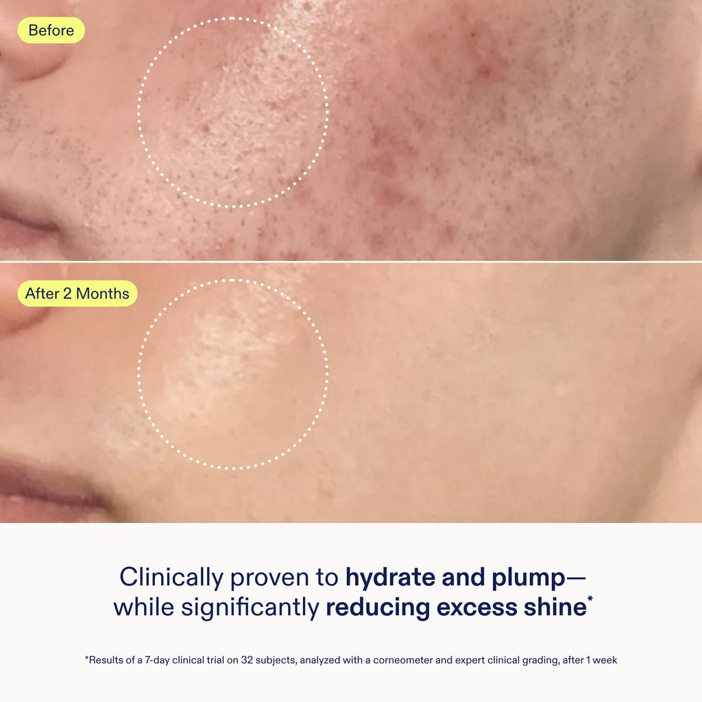 Skinfix Skin Barrier Restoring Gel Cream Refill – Lightweight Hydration for Normal/Combination Skin