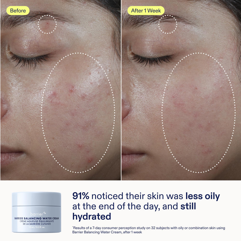 Skinfix Balancing Cleanse + Moisturize Set – Hyaluronic Acid, Mini Ceramide + Ectoin Gentle Gel Cleanser & Barrier Balancing Water Cream – Vegan