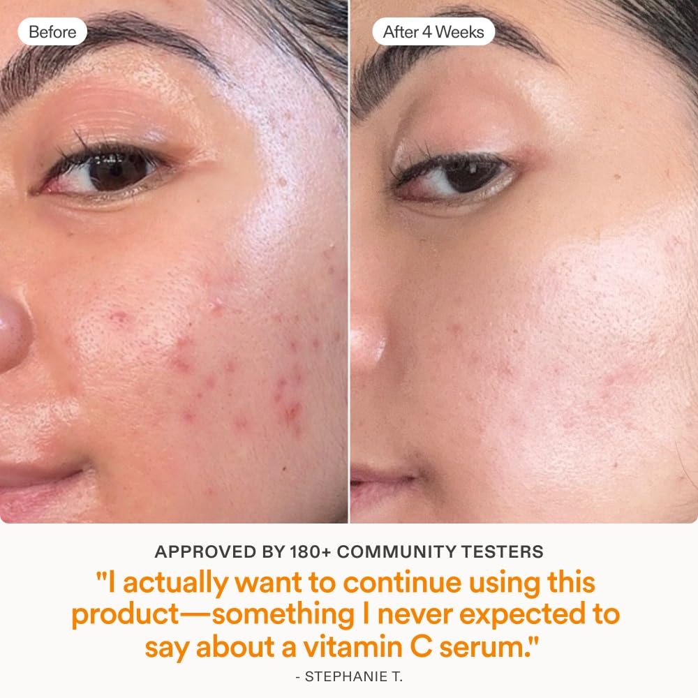 Skinfix Brighten + Firm 15% Vitamin C Serum for Face | Fade Dark Spots & Fine Lines