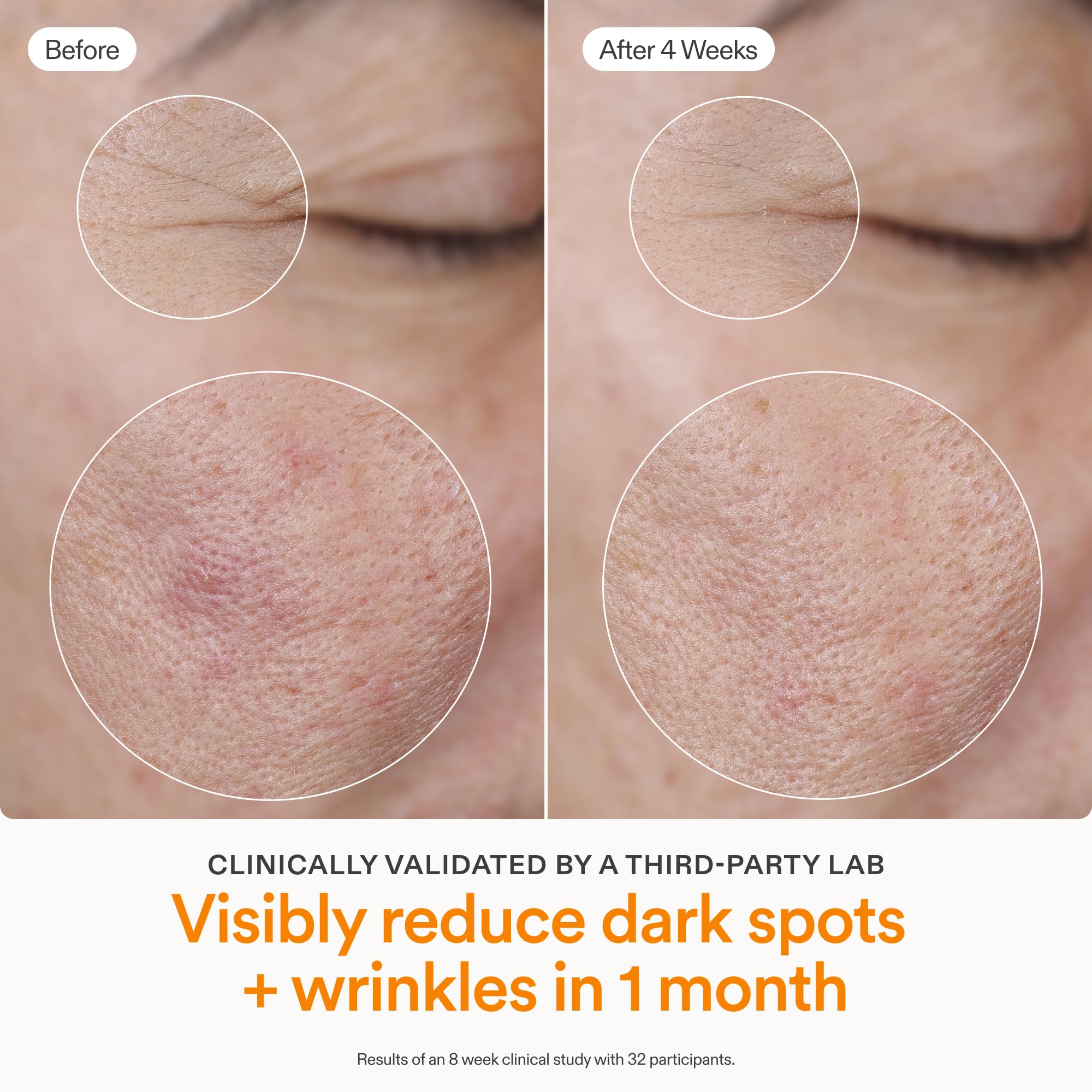Skinfix Brighten + Firm 15% Vitamin C Serum for Face | Fade Dark Spots & Fine Lines