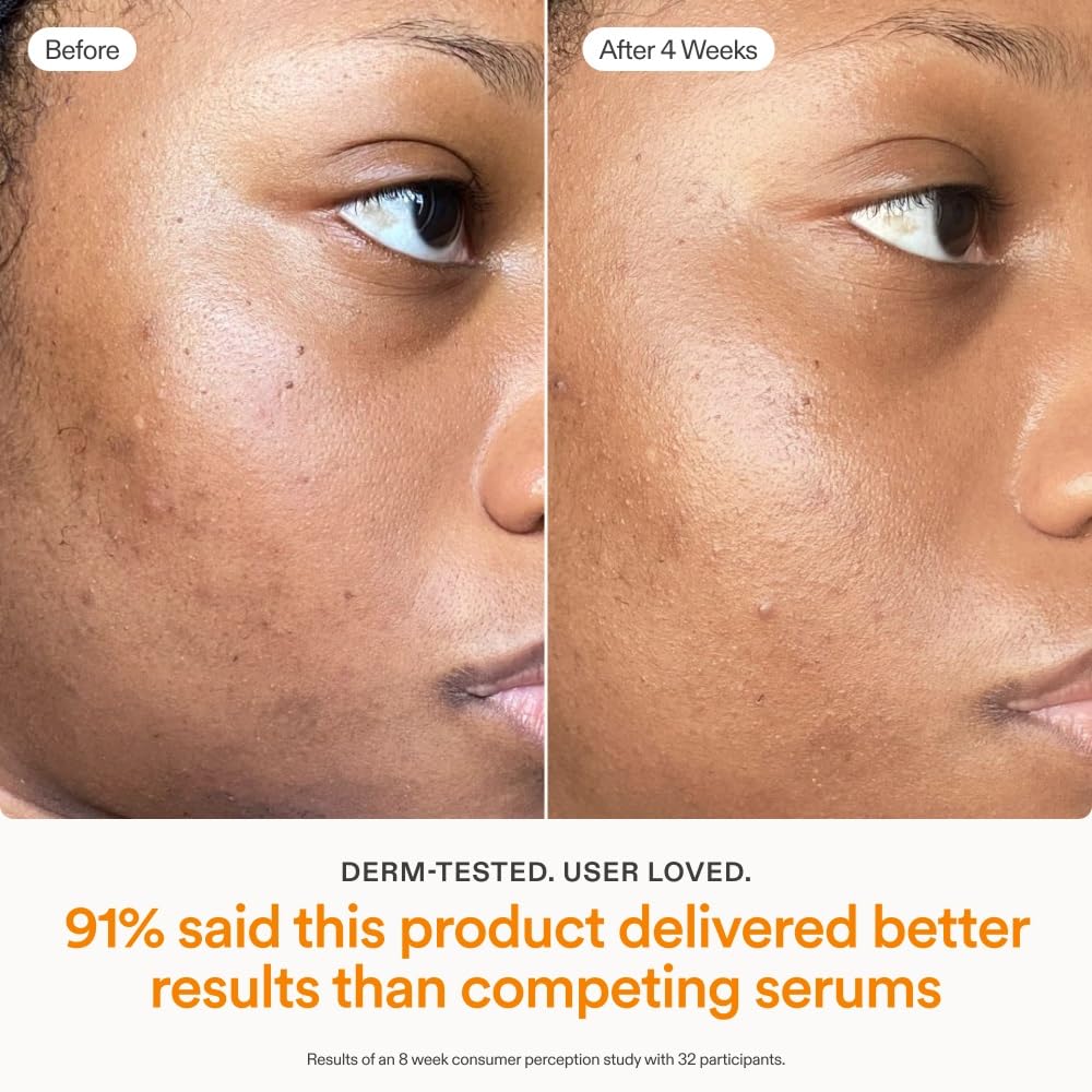 Skinfix Brighten + Firm 15% Vitamin C Serum for Face | Fade Dark Spots & Fine Lines