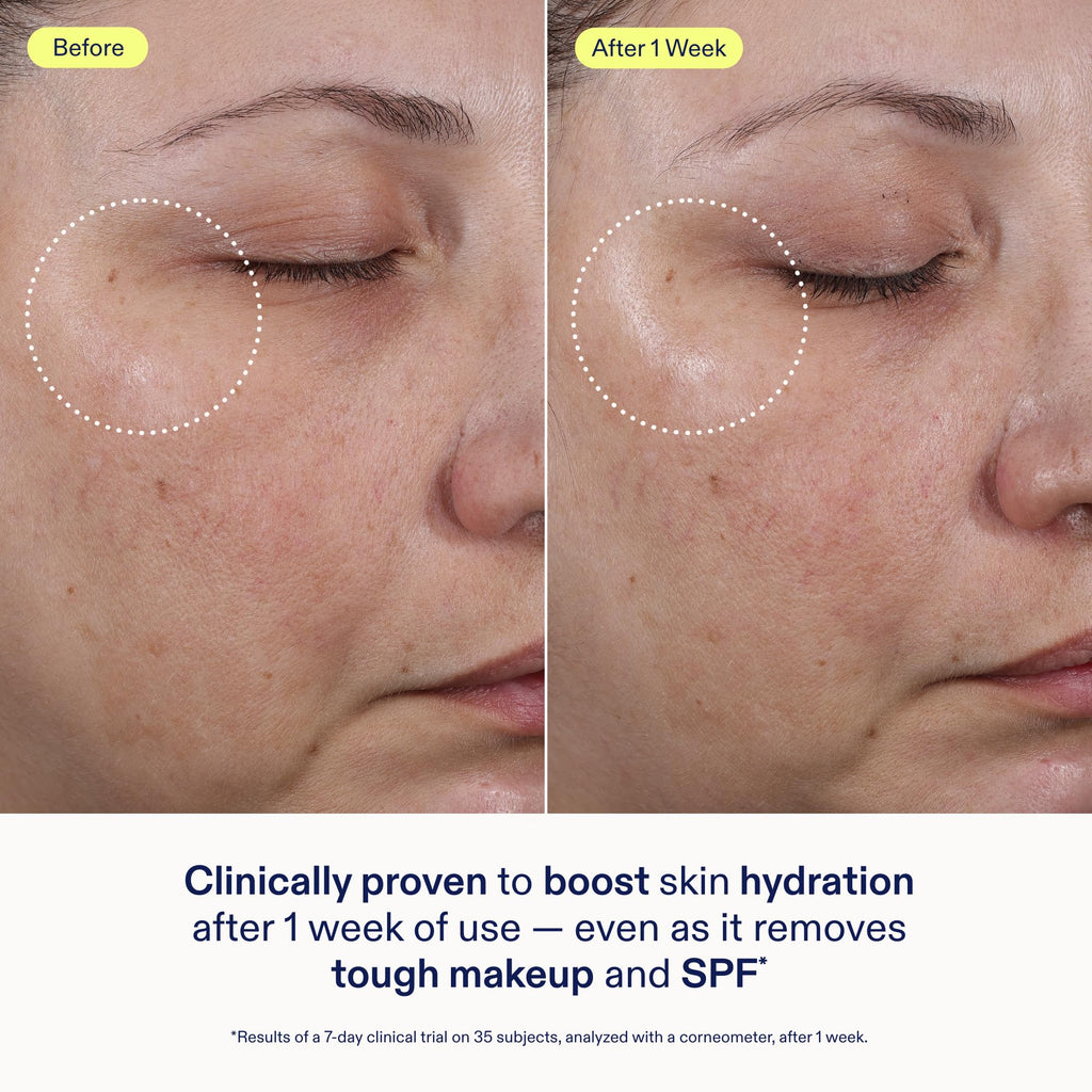 Skinfix Ceramide + Ectoin Gentle Gel Cleanser Mini – Removes Makeup & SPF, Hydrates Skin | Vegan & Cruelty-Free